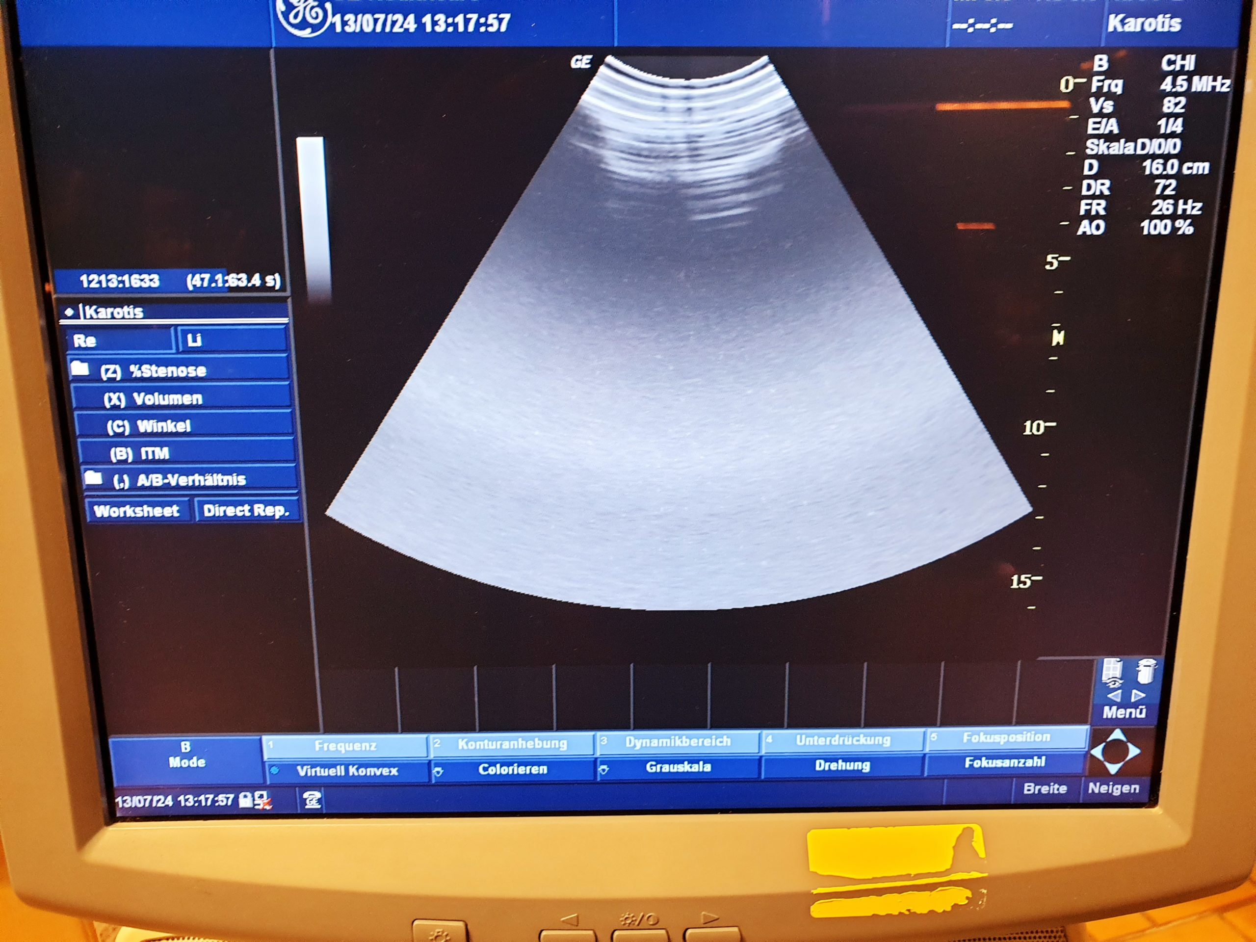 GE 4D3C-L 3D 4D Curved Array Schallkopf thumbnail 18