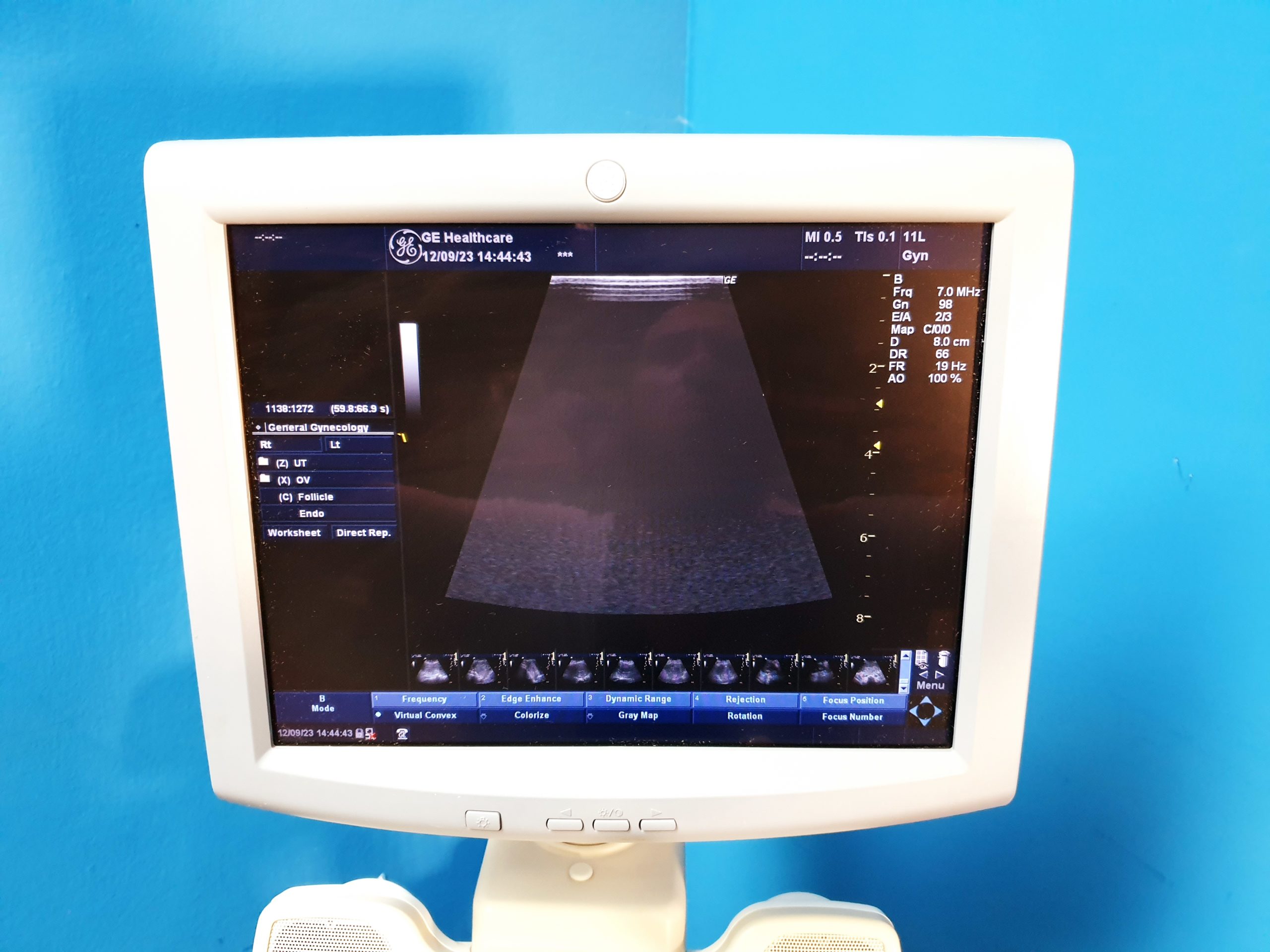 GE LOGIQ P5 + 4C + E8C + 11L Fardoppler – Doppler thumbnail 11
