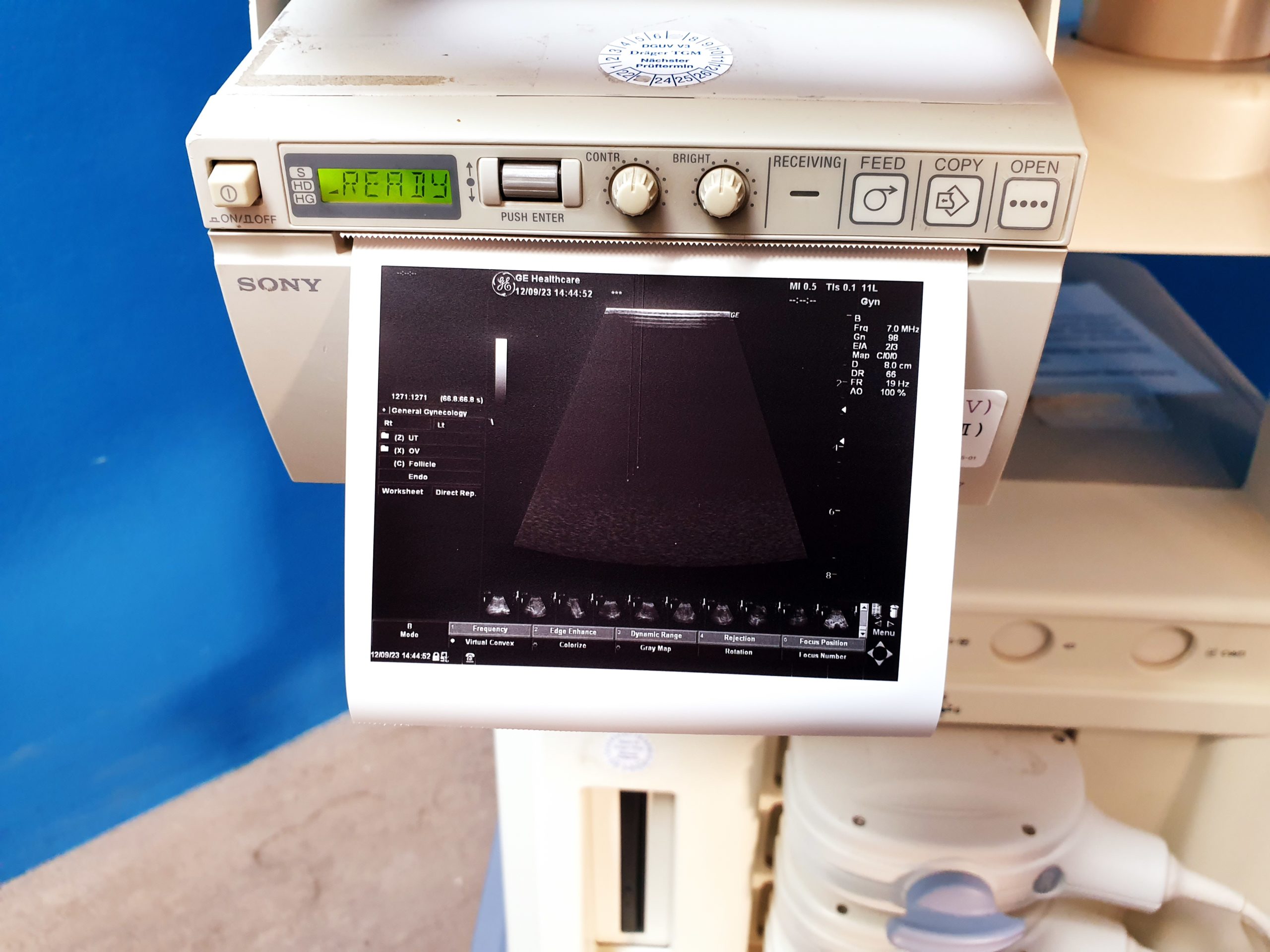 GE LOGIQ P5 + 4C + E8C + 11L Fardoppler – Doppler thumbnail 12