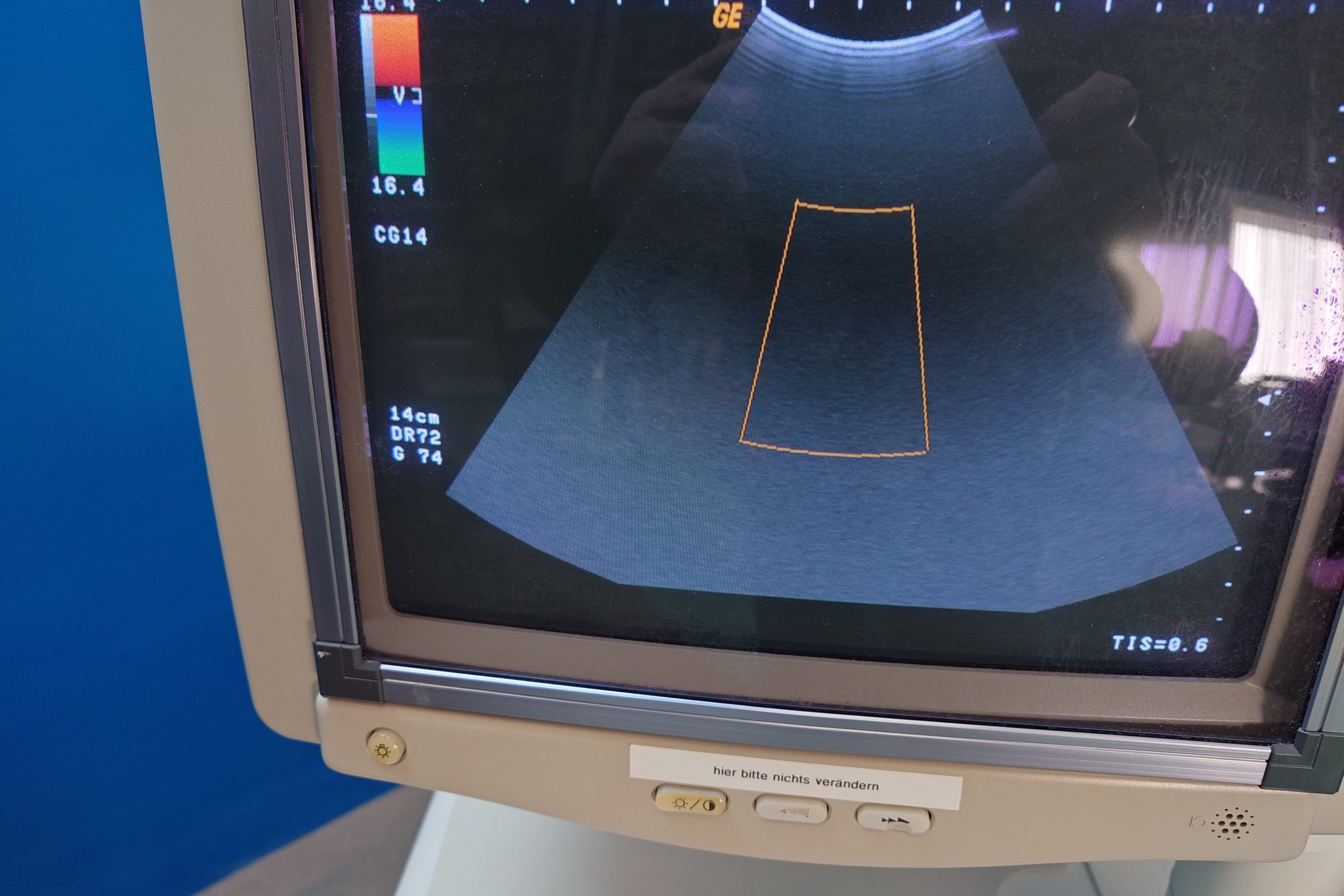 GE Logiq 500 Farbdoppler + Konvex, Linear und Mikrokonvex – C551 + L764 + C721 thumbnail 4
