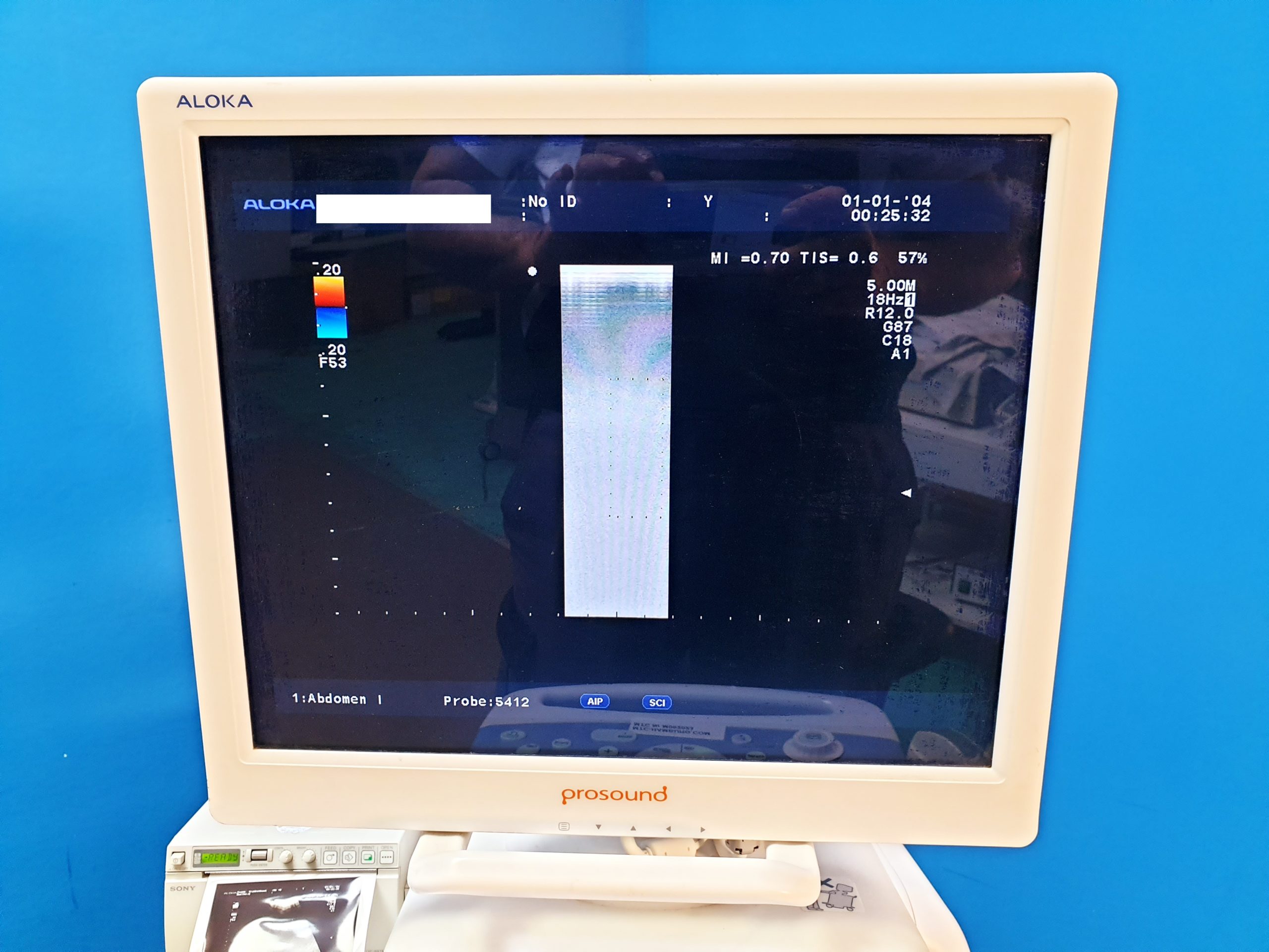 Aloka alpha 10 mit konvex und Linear thumbnail 11