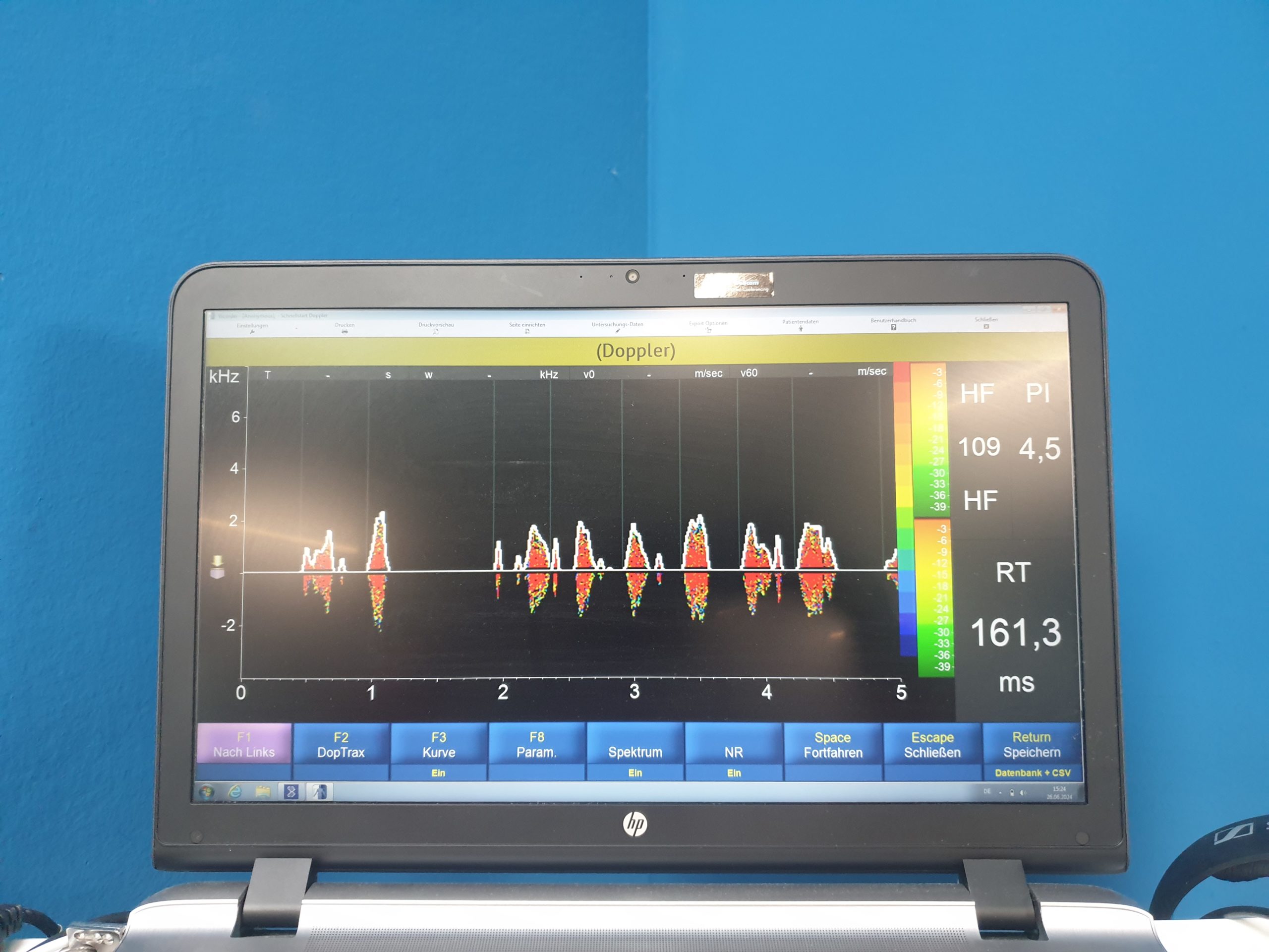 Skidmore Medical Vicorder V8.1.6708 5Mhz und 8Mhz Sonden Doppler, PVR, PPG, Drucke, PWV, PWA, ABI, OSC BP, Austrom, Reflux DOM 2020 thumbnail 2