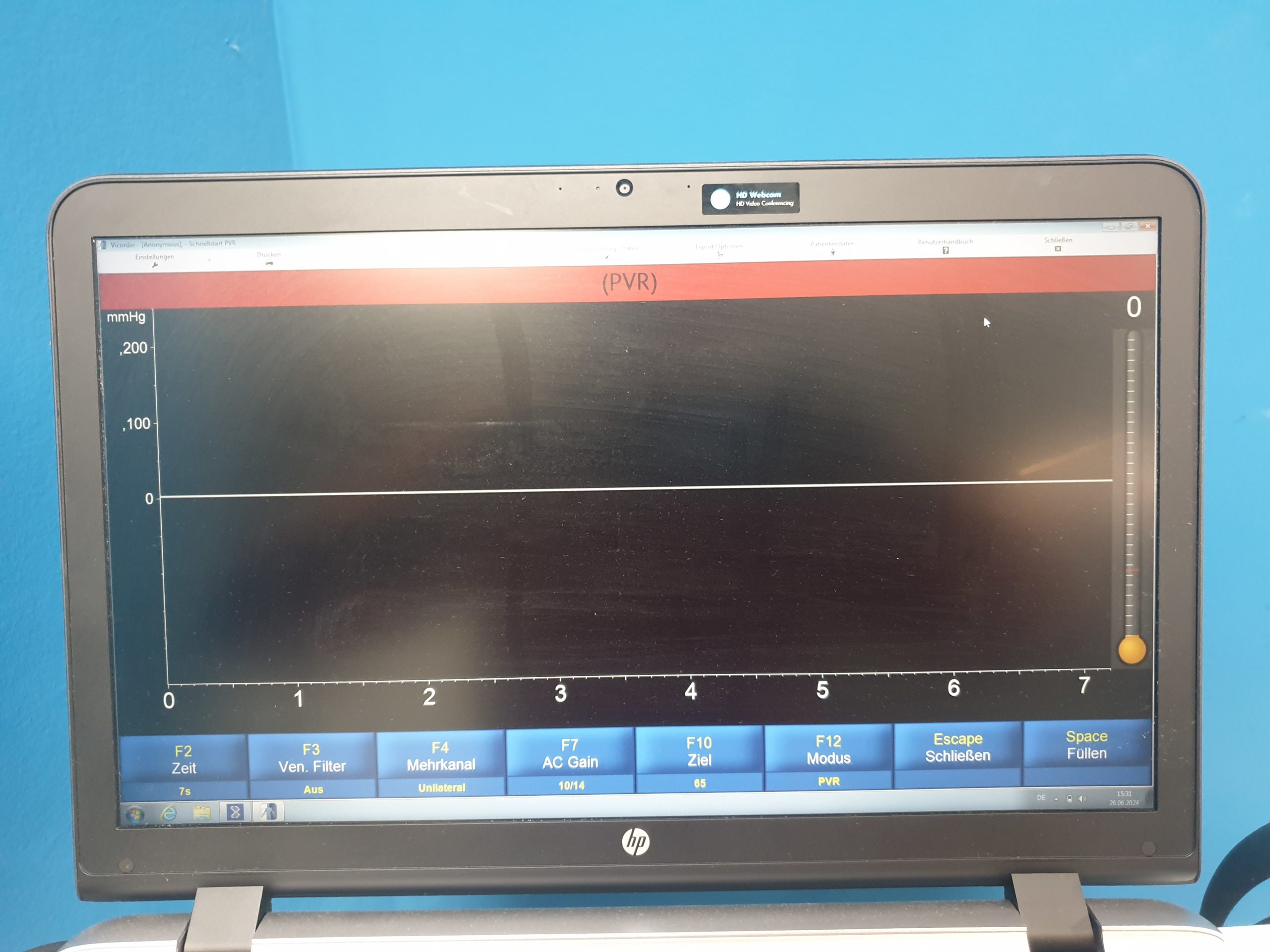 Skidmore Medical Vicorder V8.1.6708 5Mhz und 8Mhz Sonden Doppler, PVR, PPG, Drucke, PWV, PWA, ABI, OSC BP, Austrom, Reflux DOM 2020 thumbnail 7