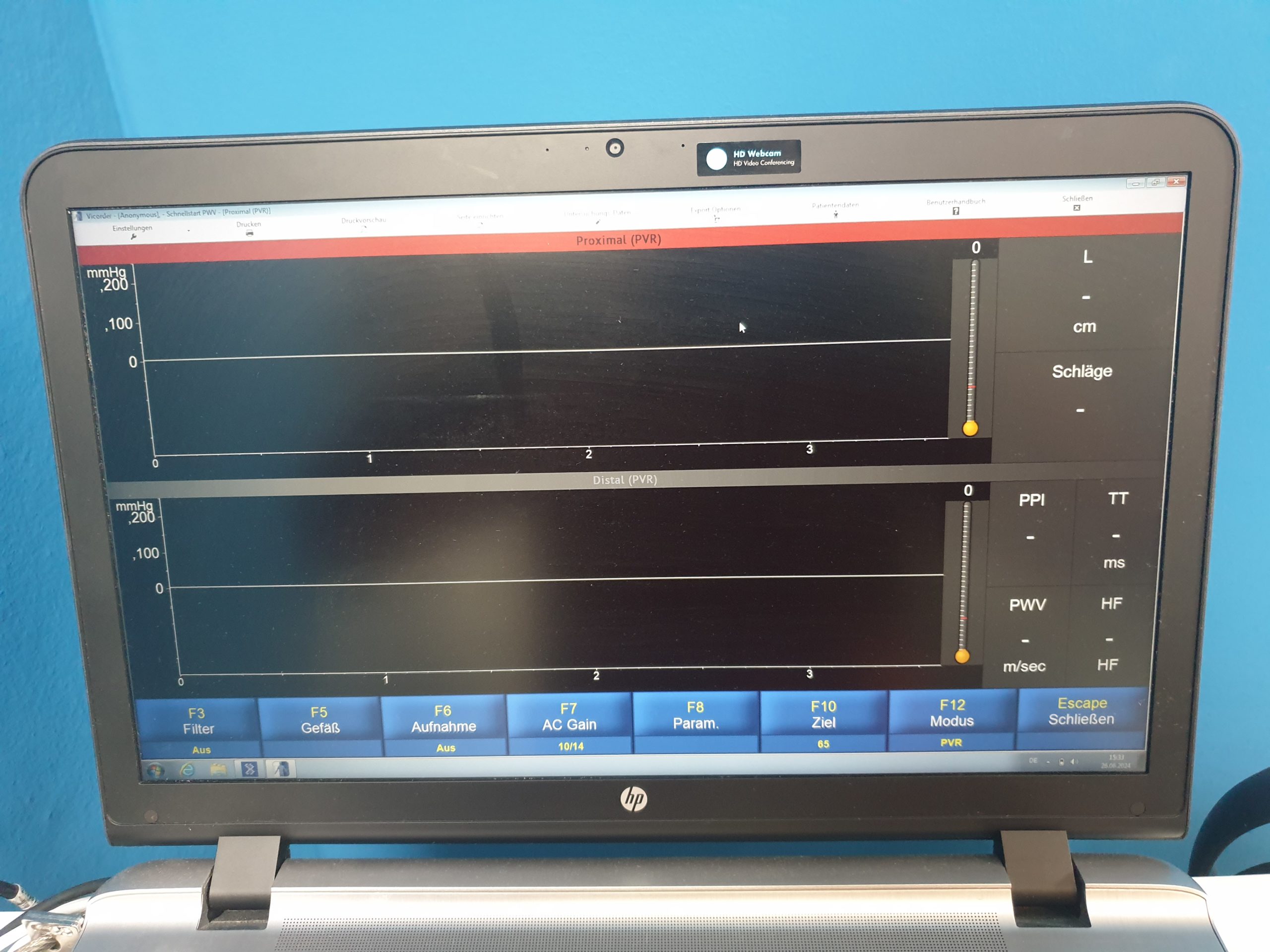 Skidmore Medical Vicorder V8.1.6708 5Mhz und 8Mhz Sonden Doppler, PVR, PPG, Drucke, PWV, PWA, ABI, OSC BP, Austrom, Reflux DOM 2020 thumbnail 9