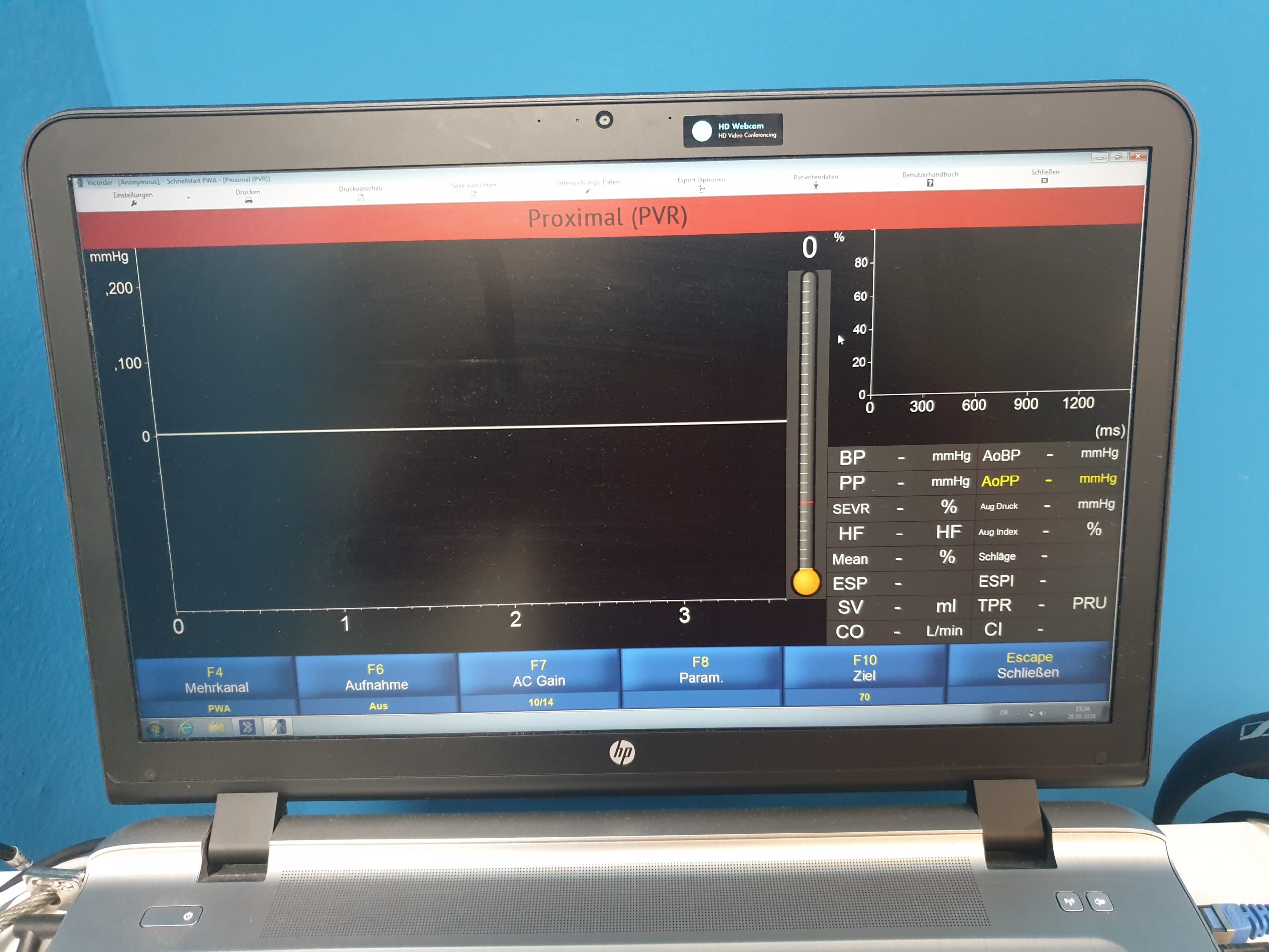 Skidmore Medical Vicorder V8.1.6708 5Mhz und 8Mhz Sonden Doppler, PVR, PPG, Drucke, PWV, PWA, ABI, OSC BP, Austrom, Reflux DOM 2020 thumbnail 10
