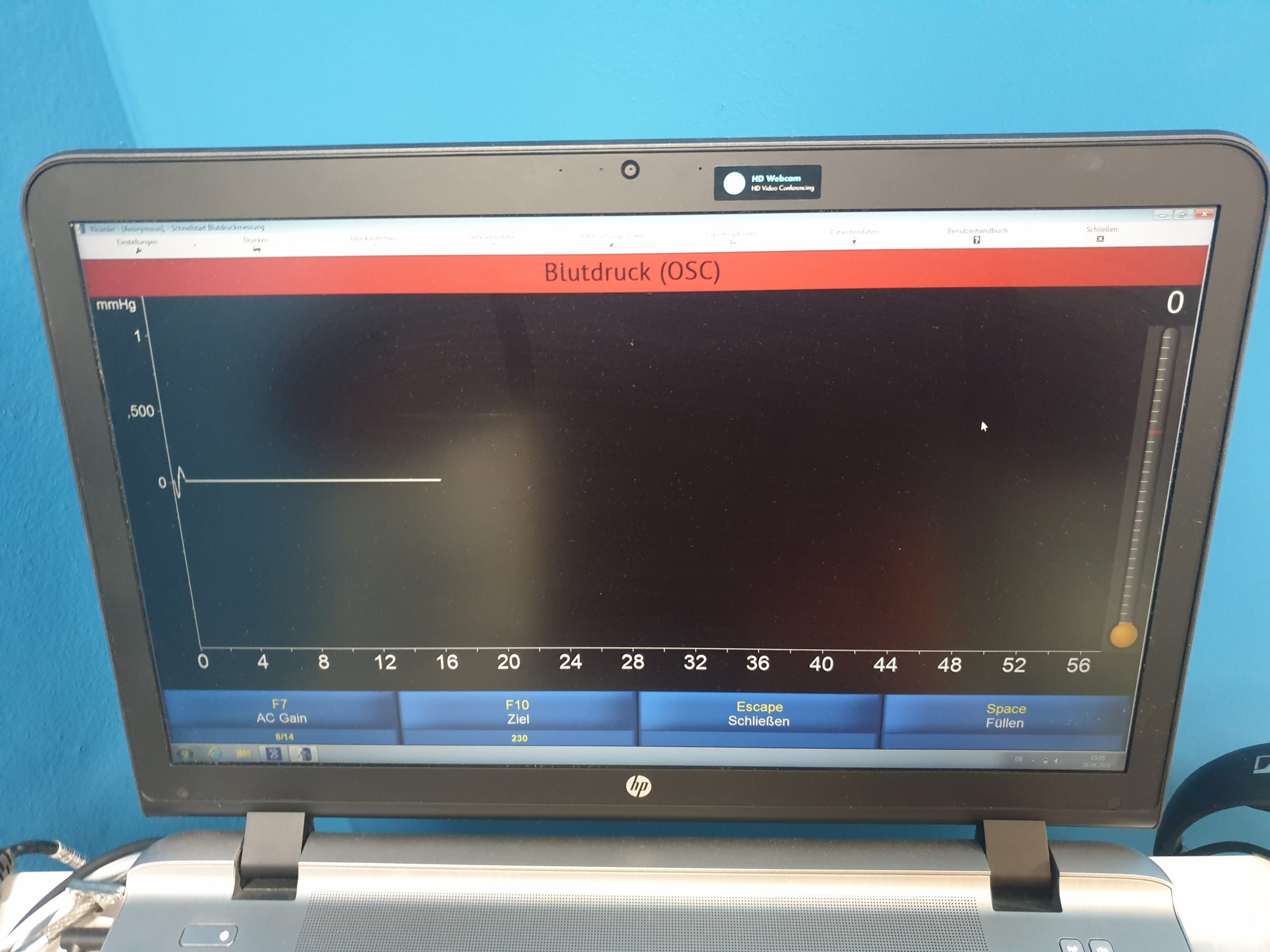 Skidmore Medical Vicorder V8.1.6708 5Mhz und 8Mhz Sonden Doppler, PVR, PPG, Drucke, PWV, PWA, ABI, OSC BP, Austrom, Reflux DOM 2020 thumbnail 12
