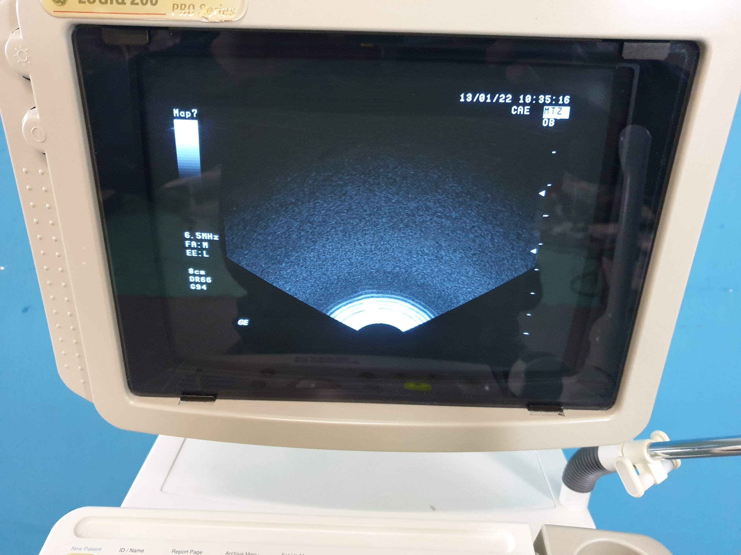 Ultraschallgerät GE LOGIQ 200 Pro mit Konvex und Endovaginal thumbnail 6