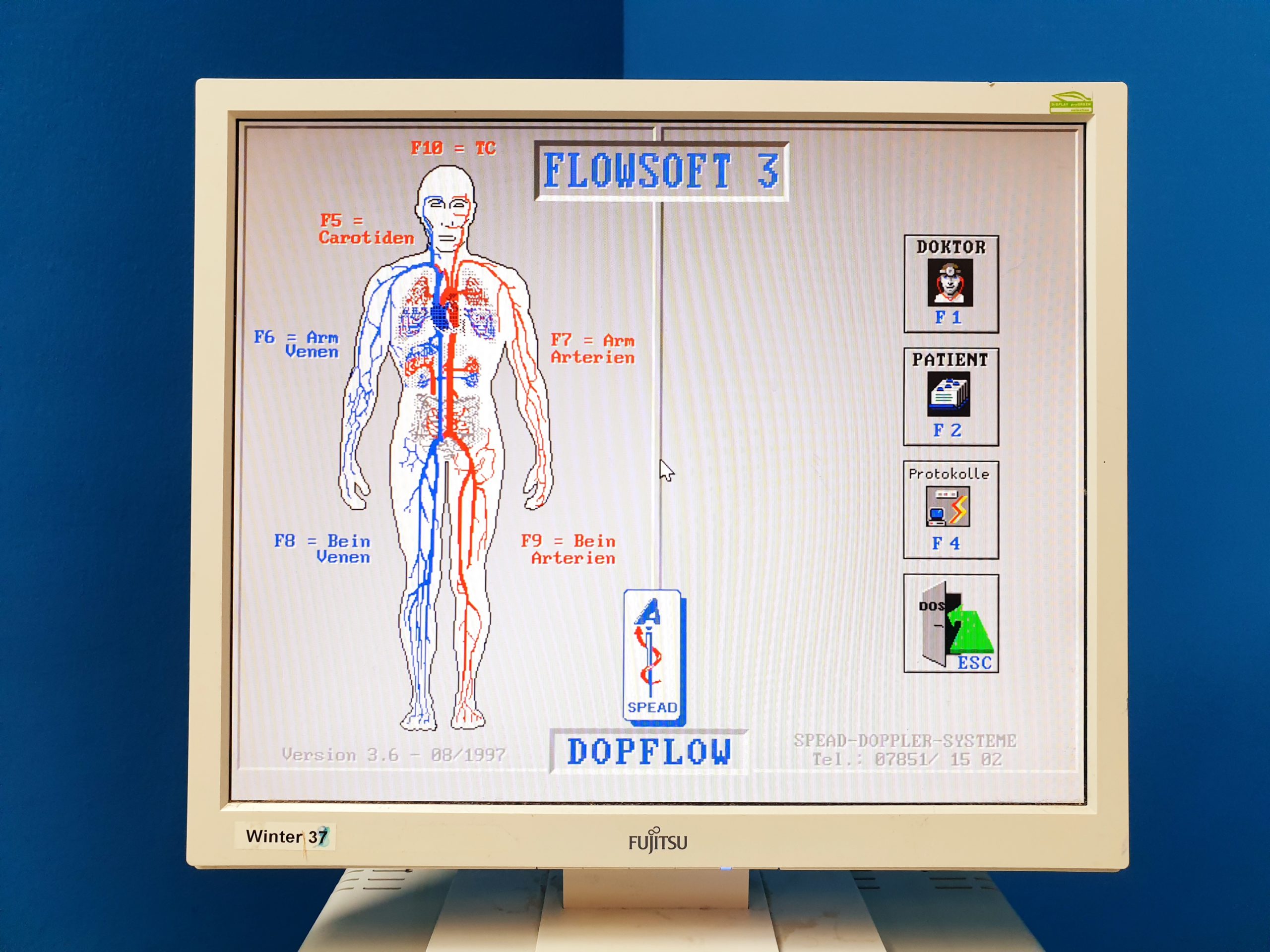 SPEAD Angiolab2 / DopFlow Flowsoft 3 Intravaskuläres Ultraschallsystem mit 2Mhz, 8Mhz thumbnail 11