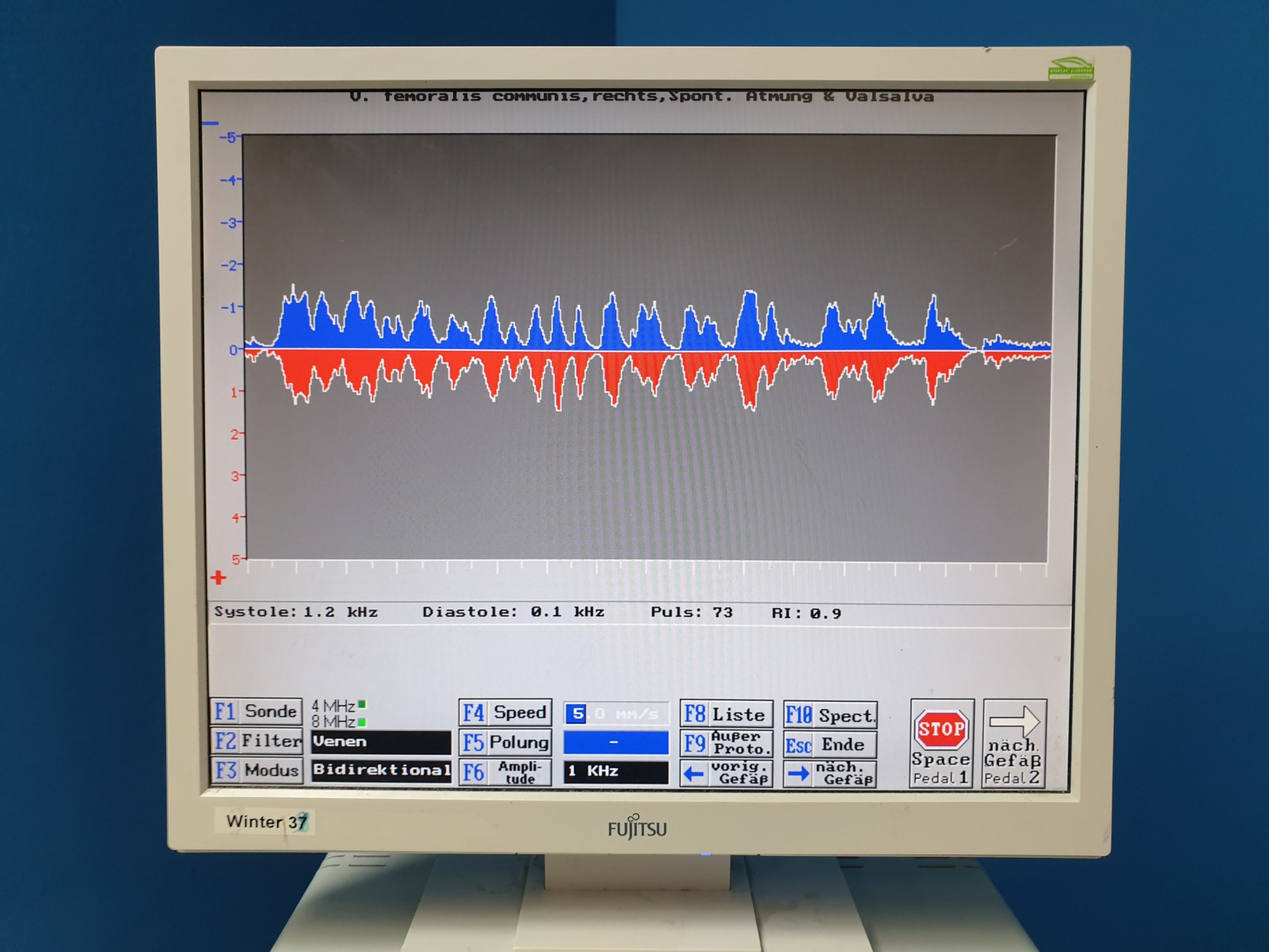 SPEAD Angiolab2 / DopFlow Flowsoft 3 Intravaskuläres Ultraschallsystem mit 2Mhz, 8Mhz thumbnail 15