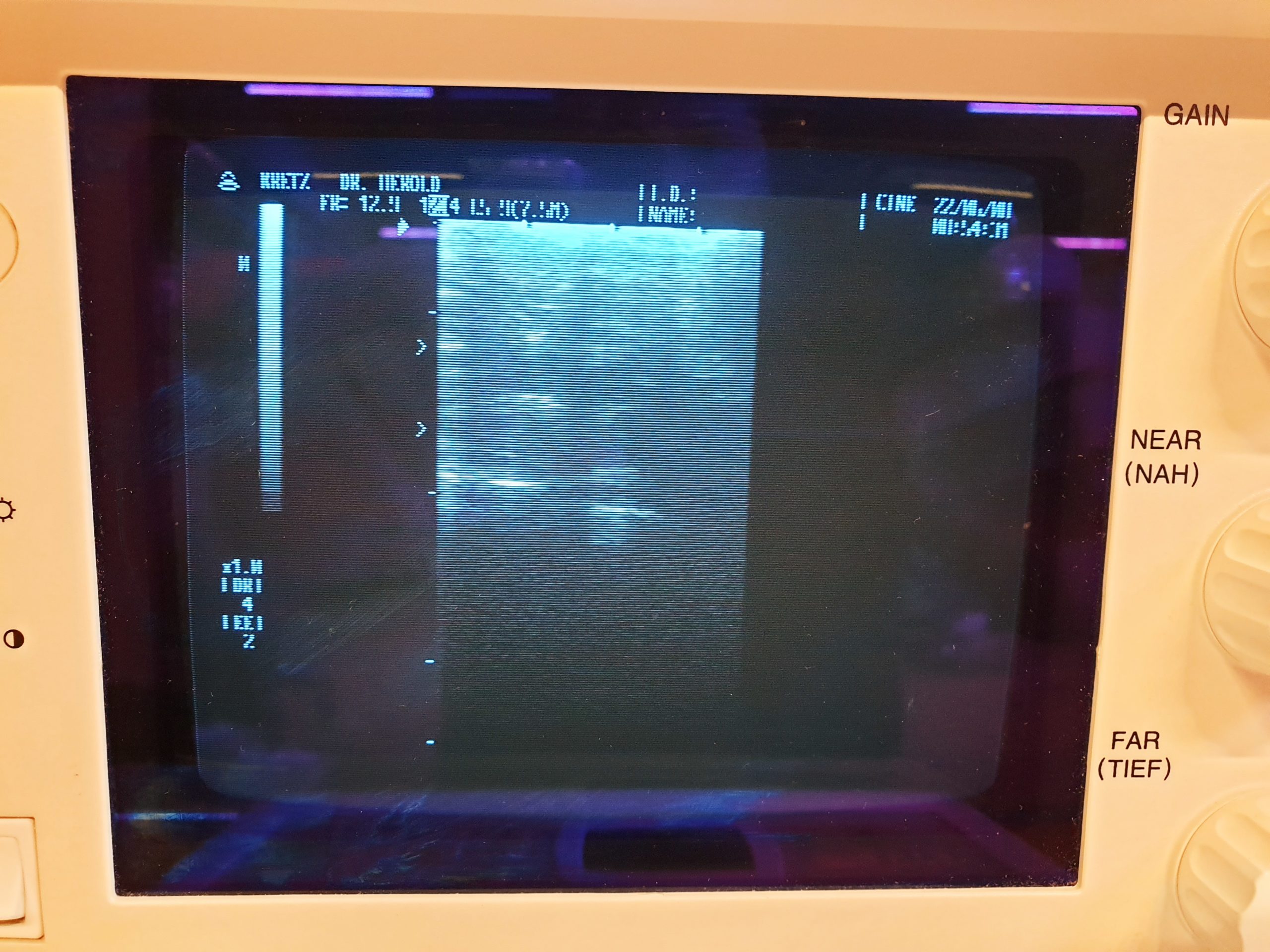 Samsung MEDISON SA600 – SA 600 + L5-9 Linear Sonde thumbnail 2