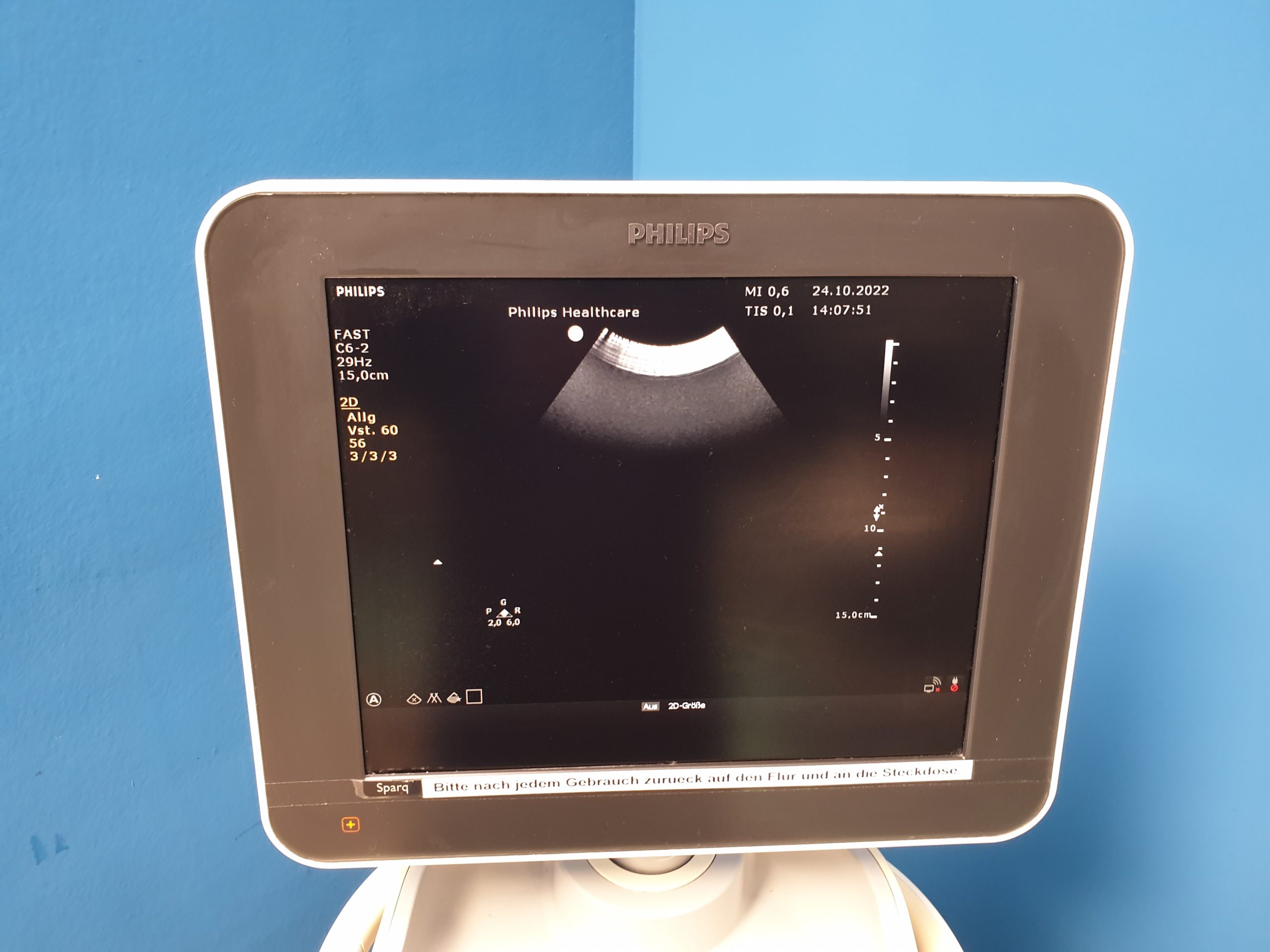 Philips Sparq mit C6-2 Konvex und L12-4 Linear Farbdoppler DOM 2013 thumbnail 4