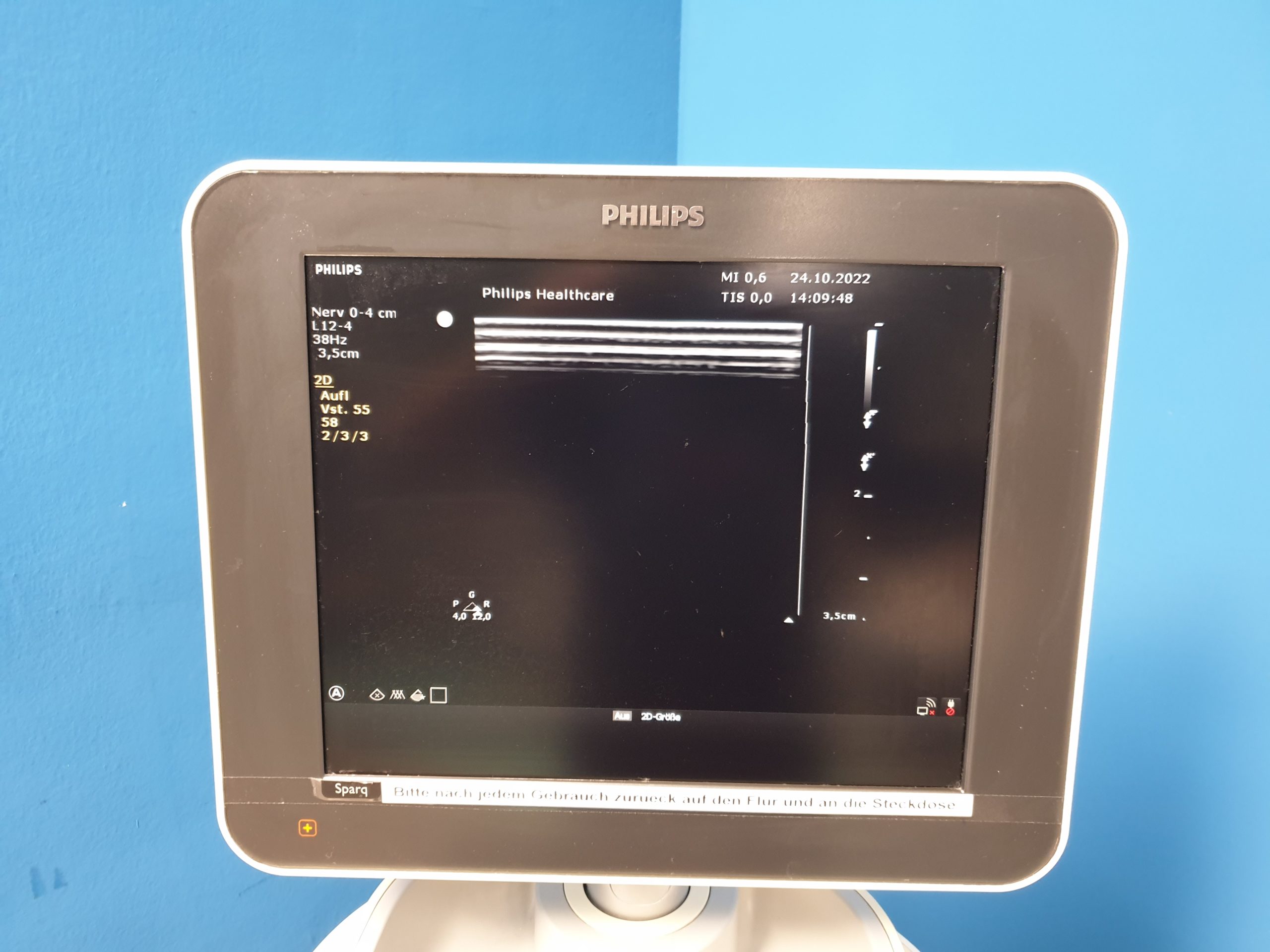 Philips Sparq mit C6-2 Konvex und L12-4 Linear Farbdoppler DOM 2013 thumbnail 7