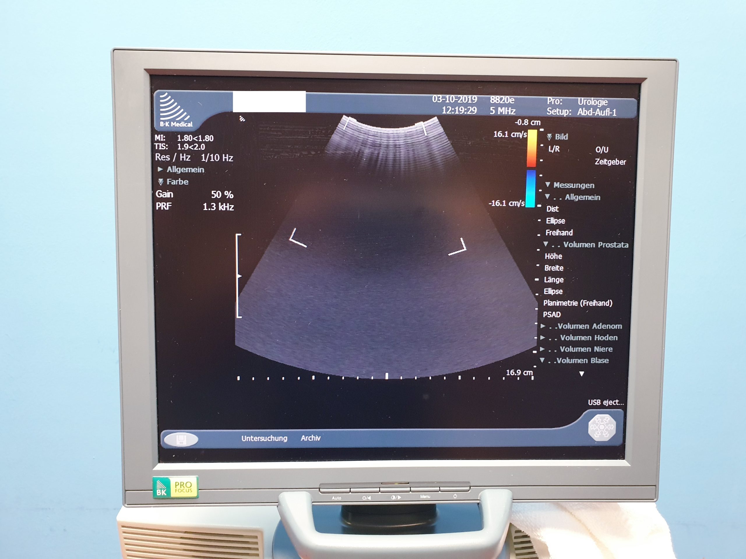 B&K // BK Medical Pro Focus mit 03 Sonden und Printer thumbnail 5