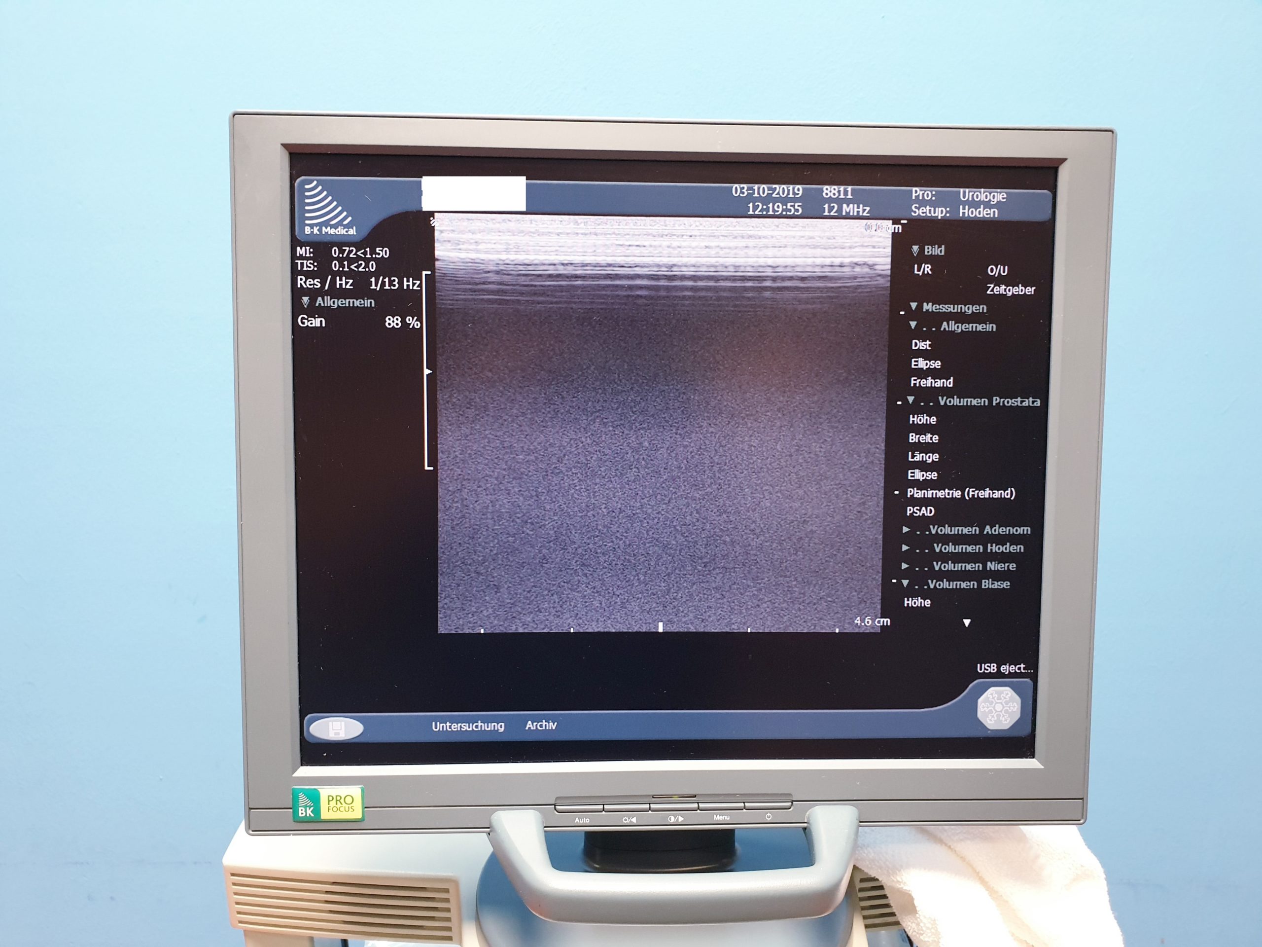 B&K // BK Medical Pro Focus mit 03 Sonden und Printer thumbnail 7