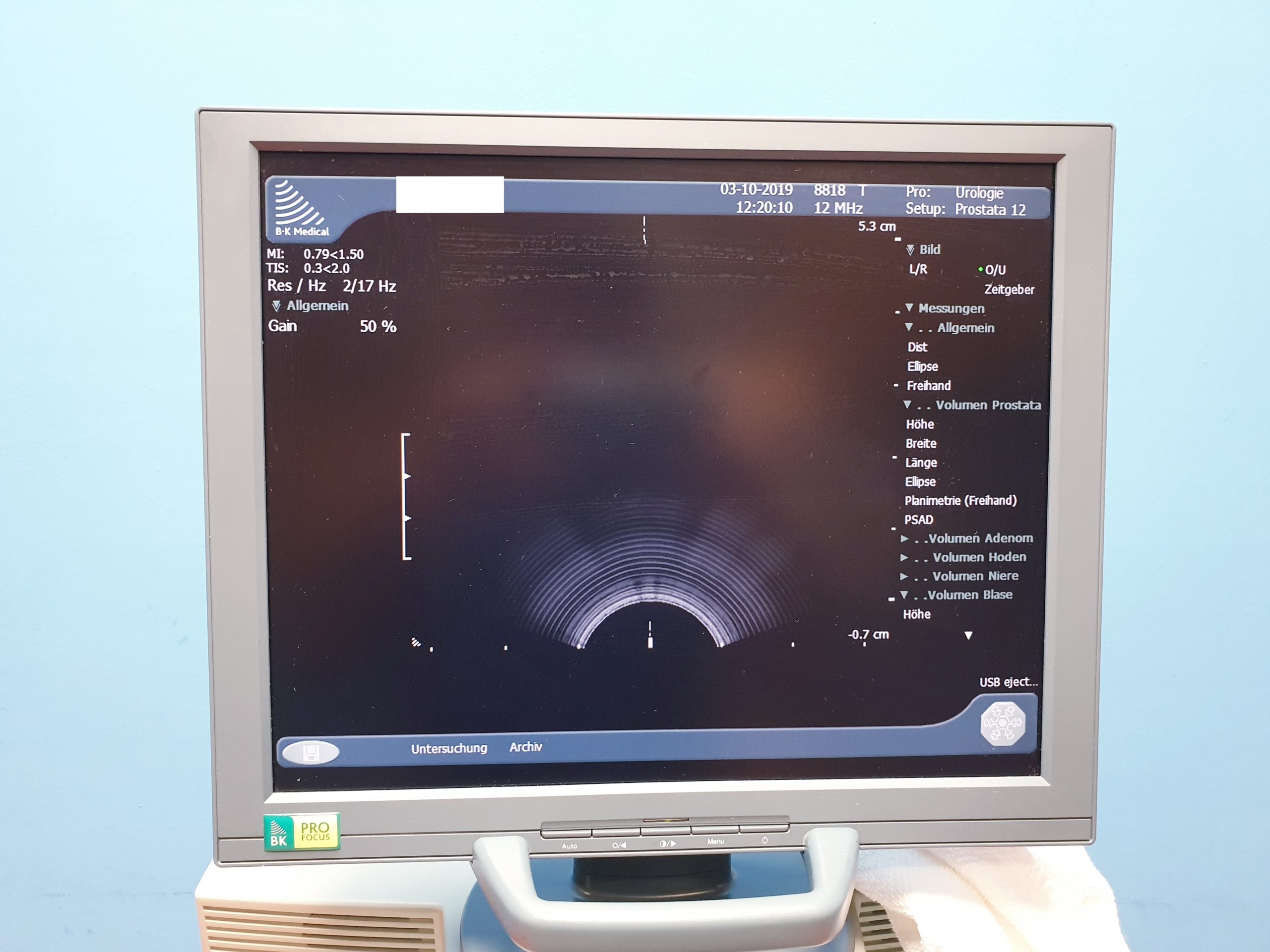B&K // BK Medical Pro Focus mit 03 Sonden und Printer thumbnail 9