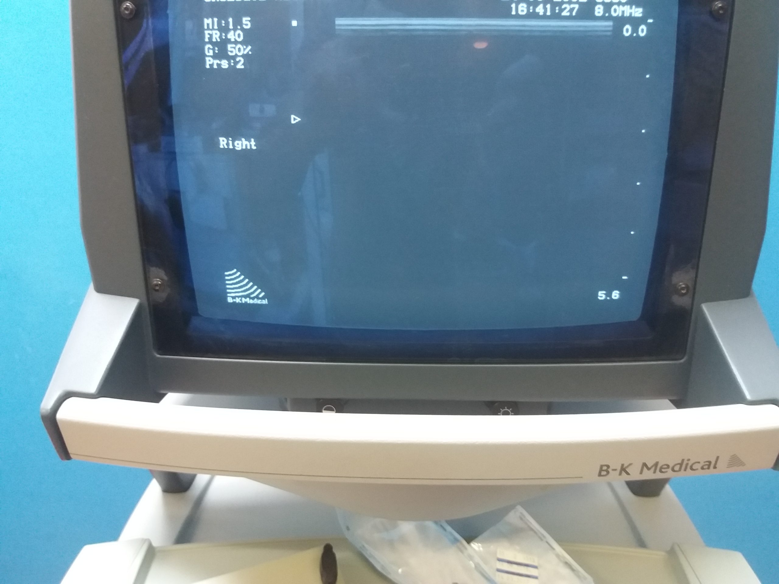 BK Medical 2101 Falcon Ultrasound mit Konvex, Linear und Printer thumbnail 3