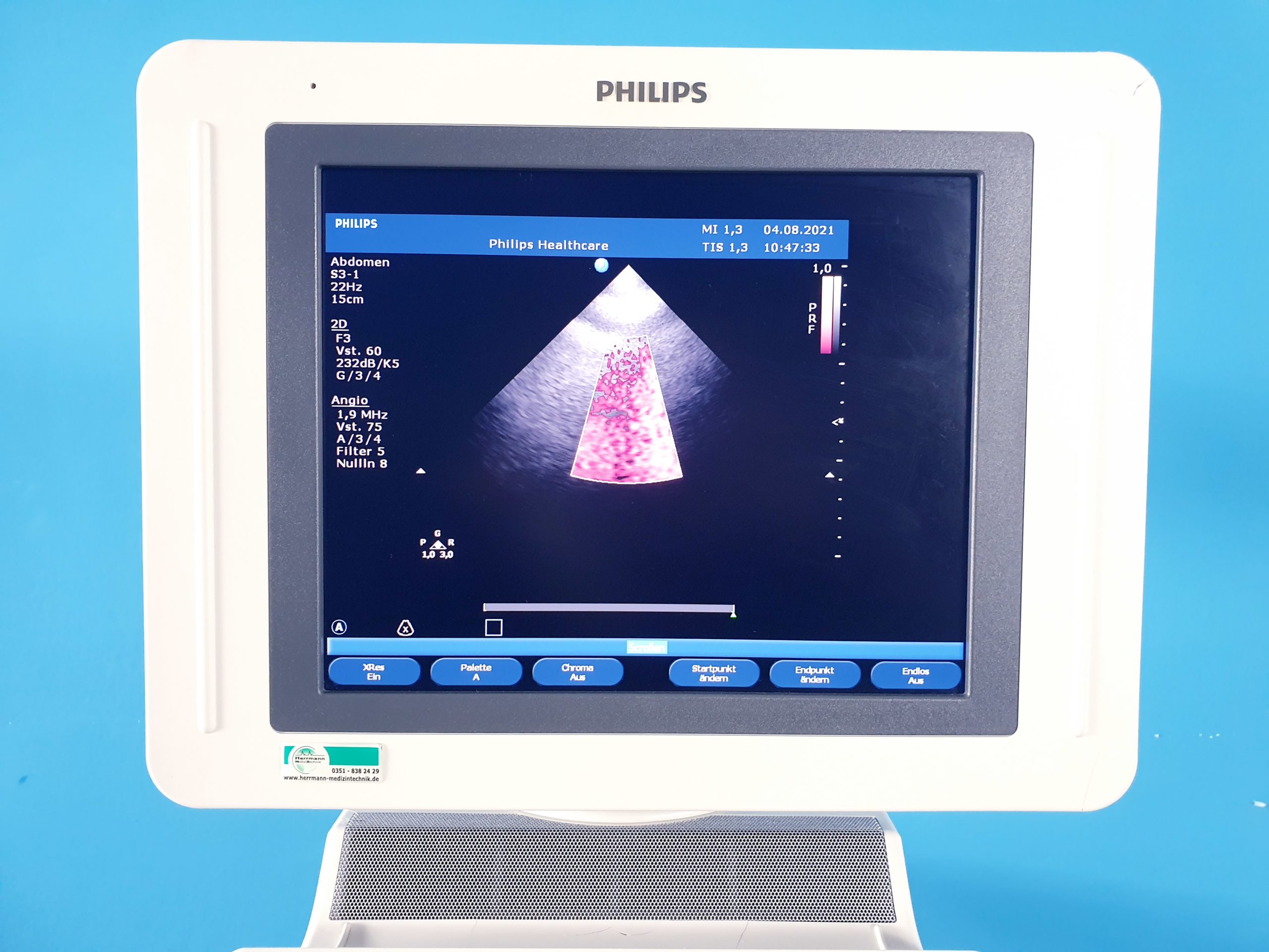 Philips HD11XE – L12-3 + C6-3 + S3-1 Kardiomaschine DOM2011 thumbnail 4