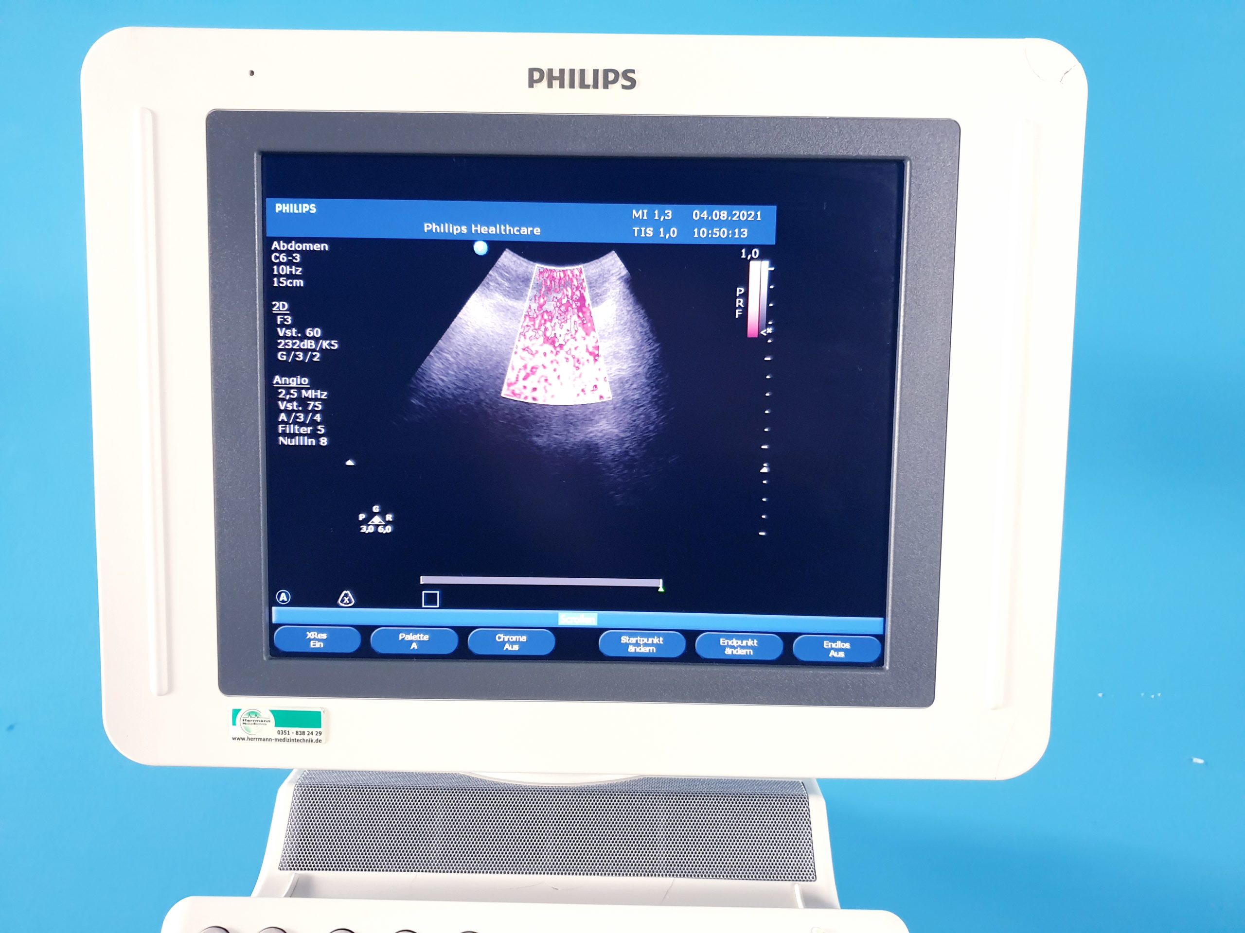 Philips HD11XE – L12-3 + C6-3 + S3-1 Kardiomaschine DOM2011 thumbnail 7