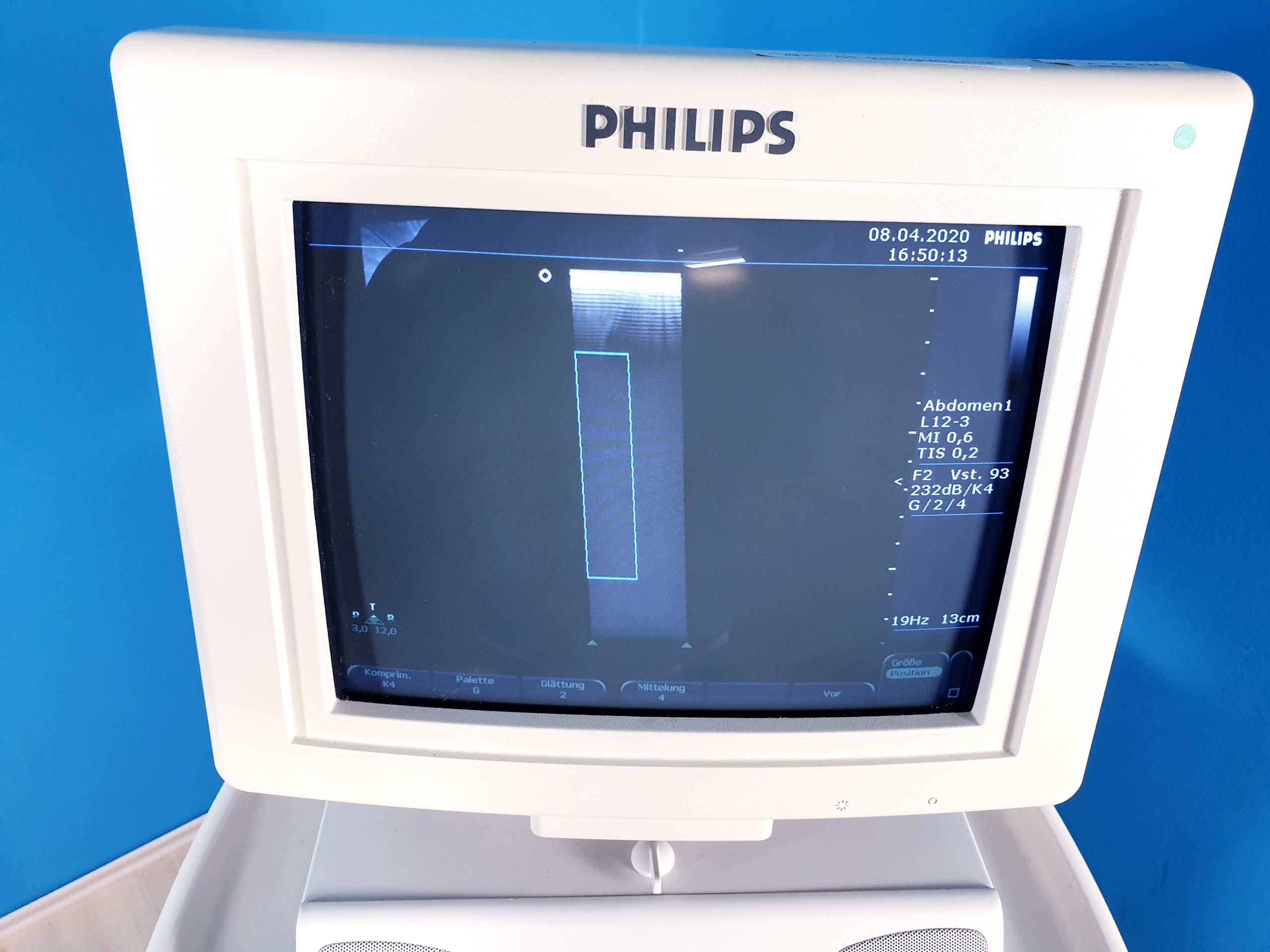 Philips EnVisor mit Konvex und Linear-Sonde Doppler, DOM 2004 thumbnail 6