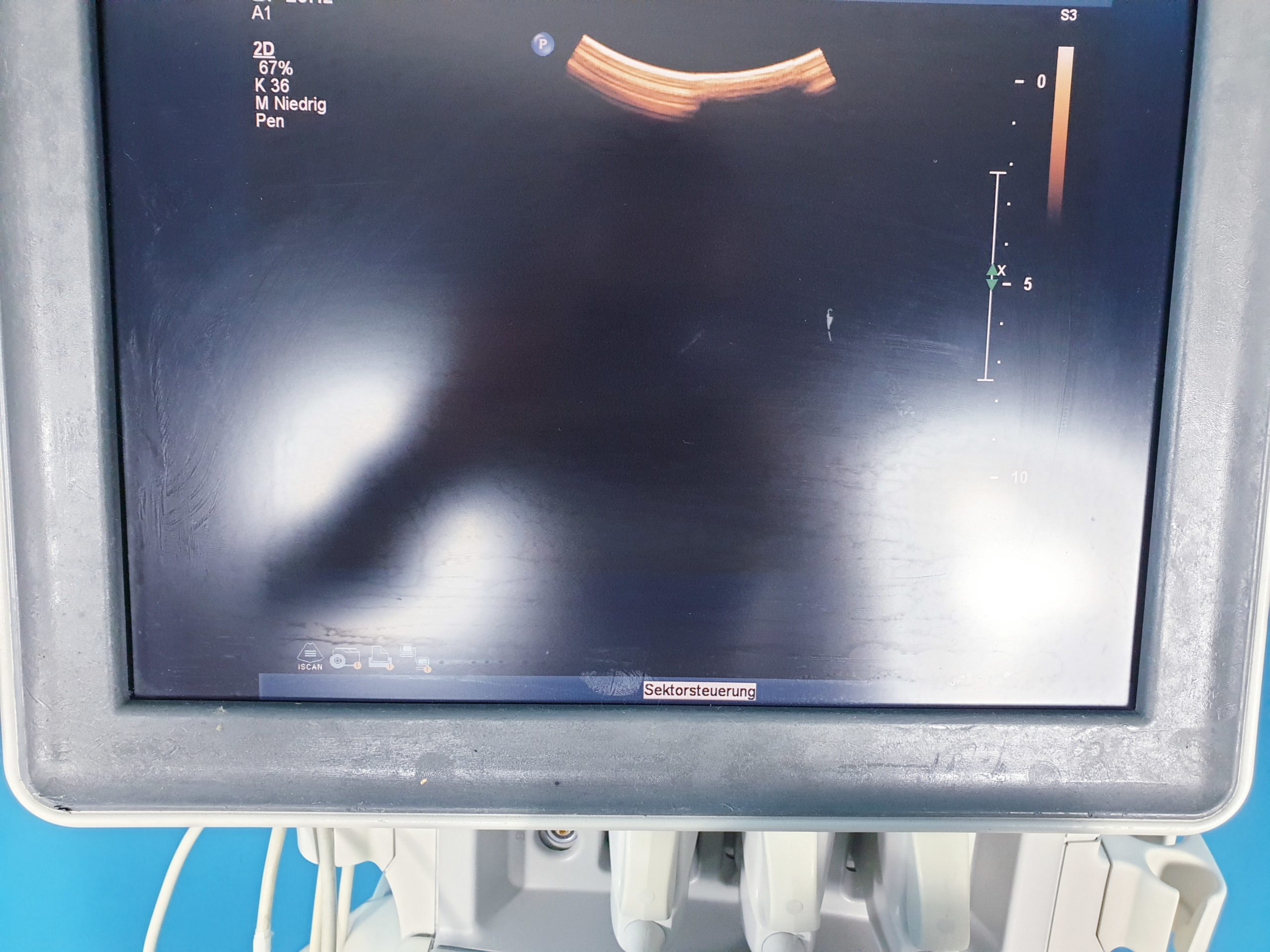 PHILIPS IU22 Ultraschallgerät mit 3 Sonden 3D/4D System thumbnail 4