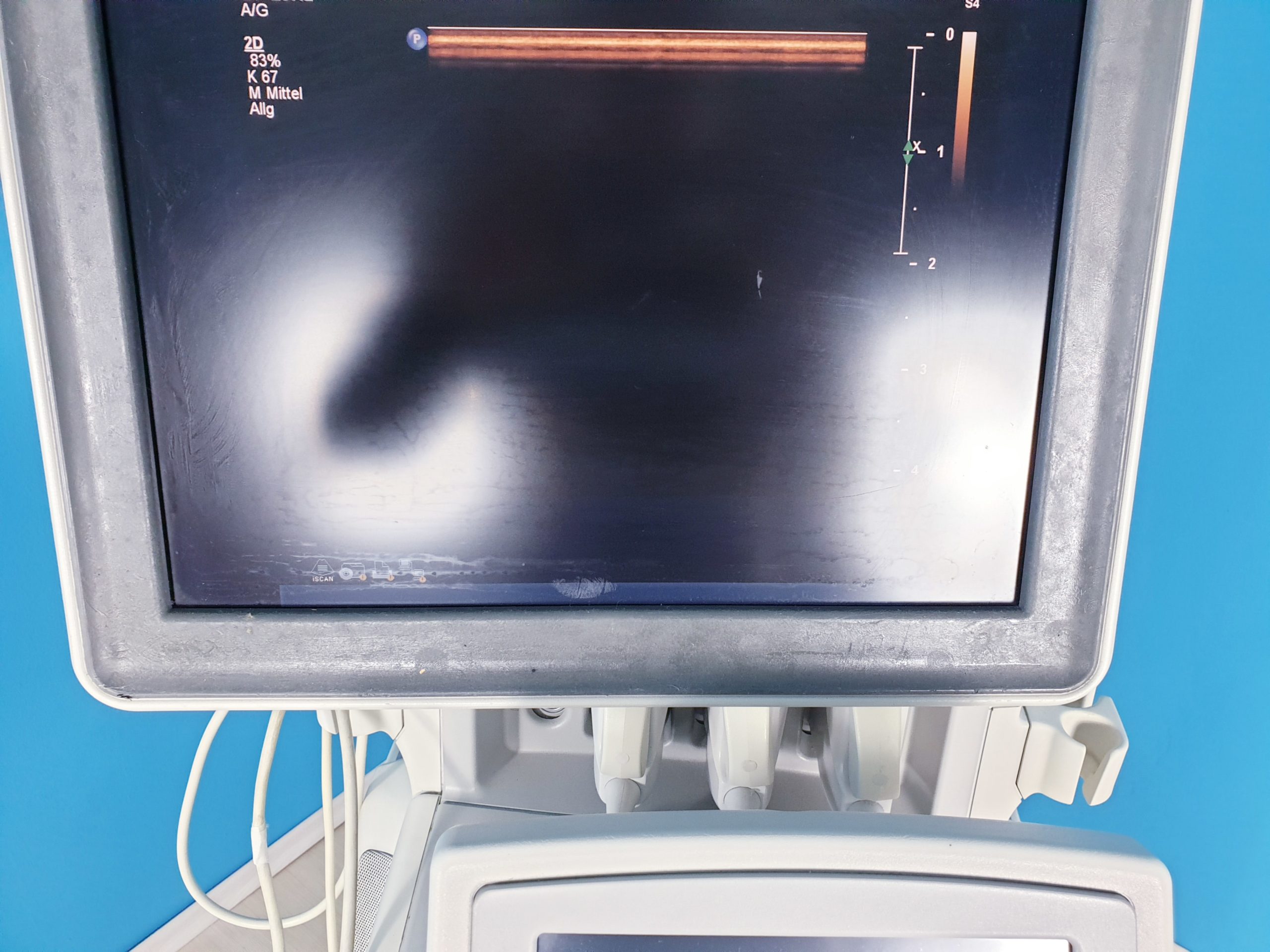 PHILIPS IU22 Ultraschallgerät mit 3 Sonden 3D/4D System thumbnail 6