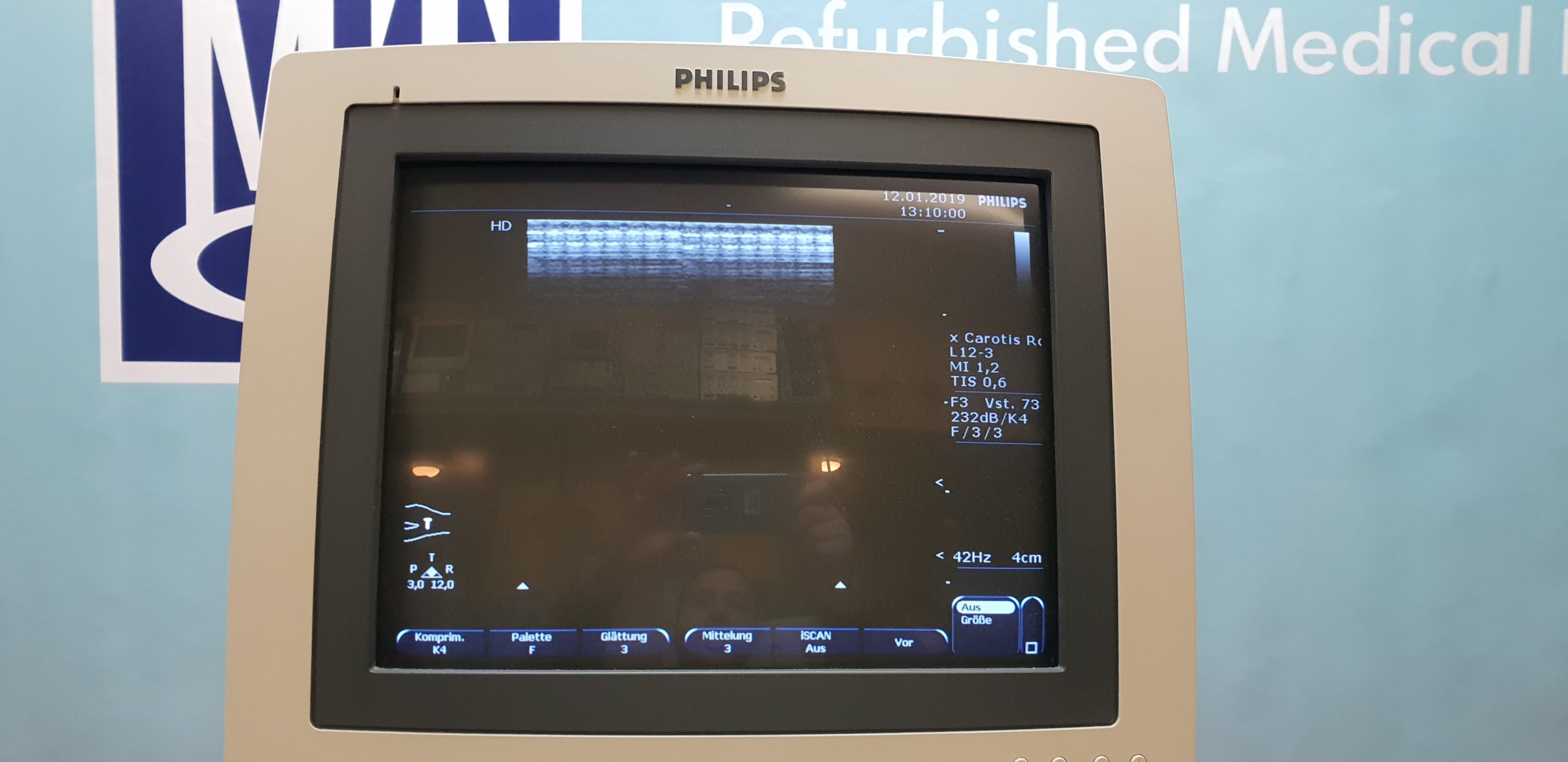Philips EnVisor C HD Ultraschallgerät Inkl 04 Sonden thumbnail 4