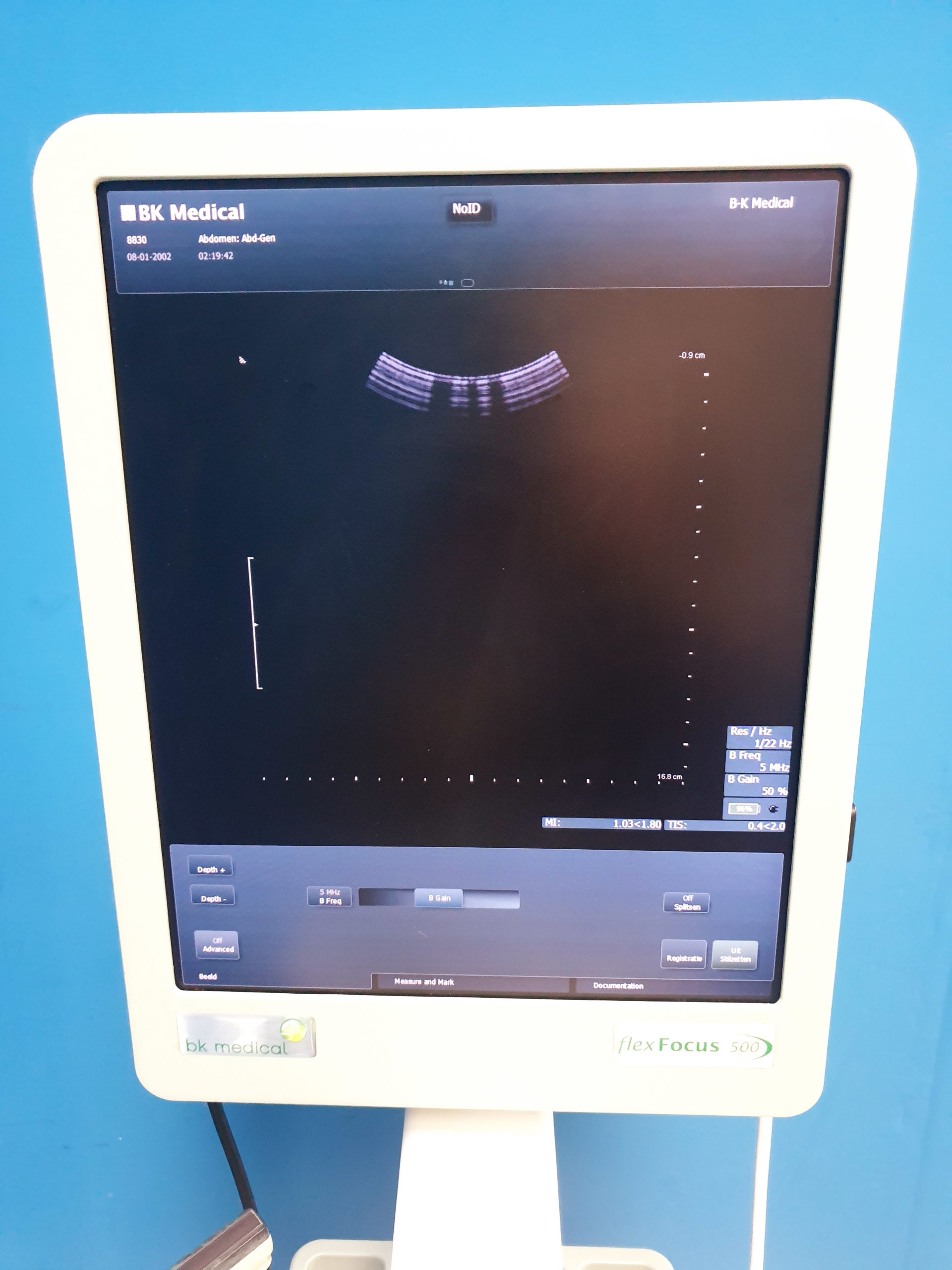 BK B&K Flex Focus 500 Ultrasound Scanner 1202 + 8830 + 8811 – 8000 – E8900 thumbnail 5