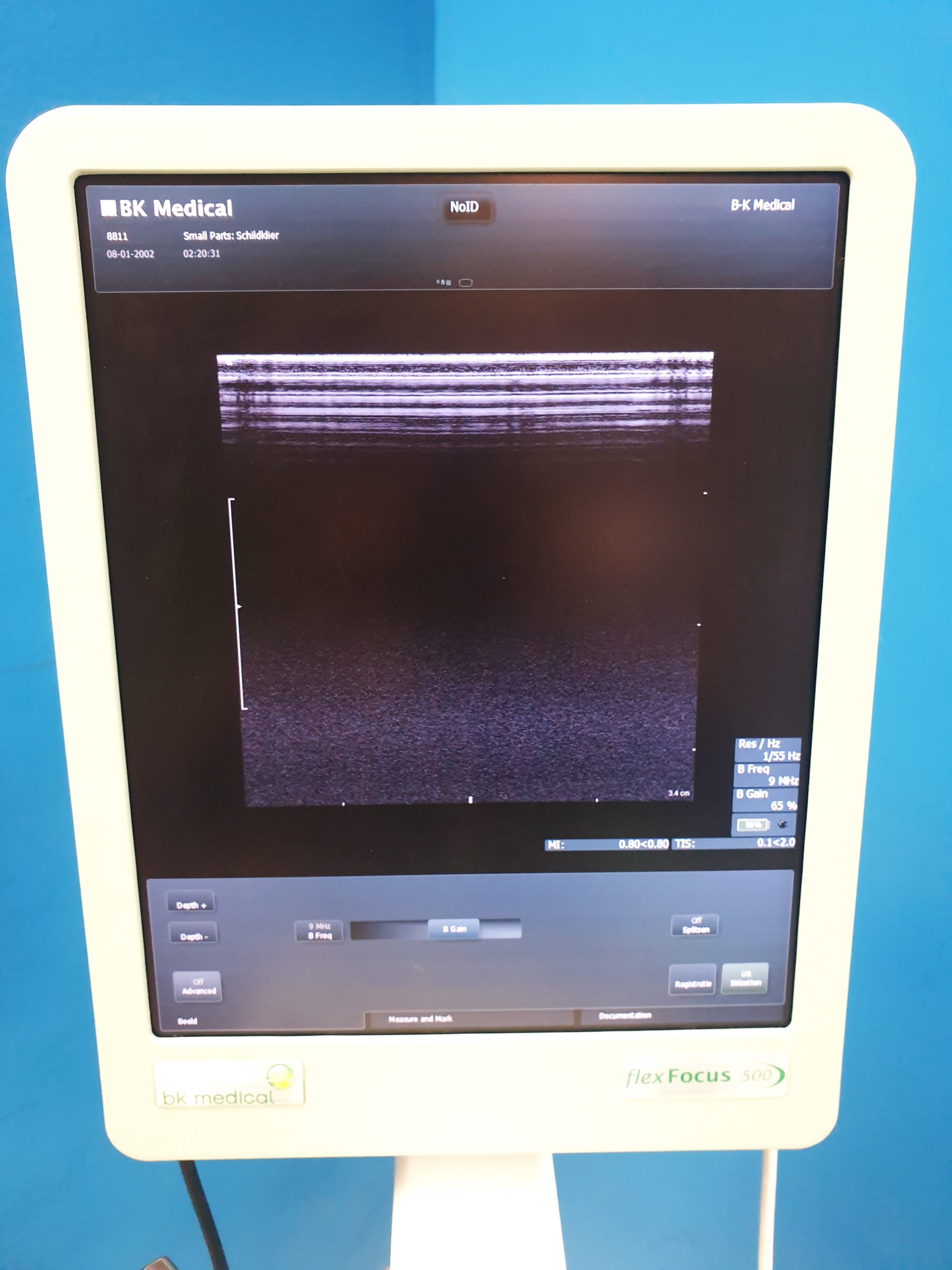 BK B&K Flex Focus 500 Ultrasound Scanner 1202 + 8830 + 8811 – 8000 – E8900 thumbnail 9