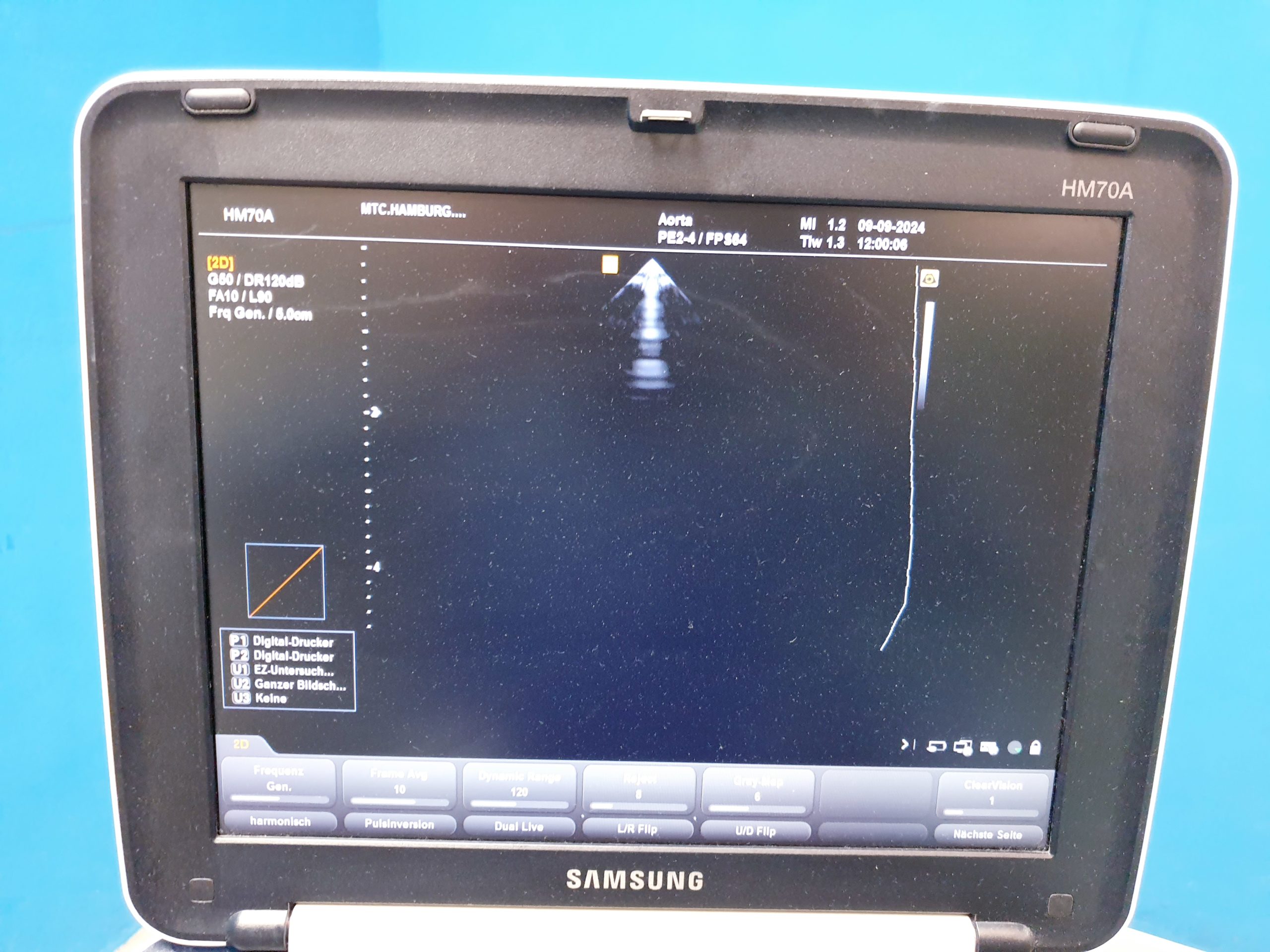 Samsung PE2-4 Sonde Echo Sonde Kardio Sonde thumbnail 3