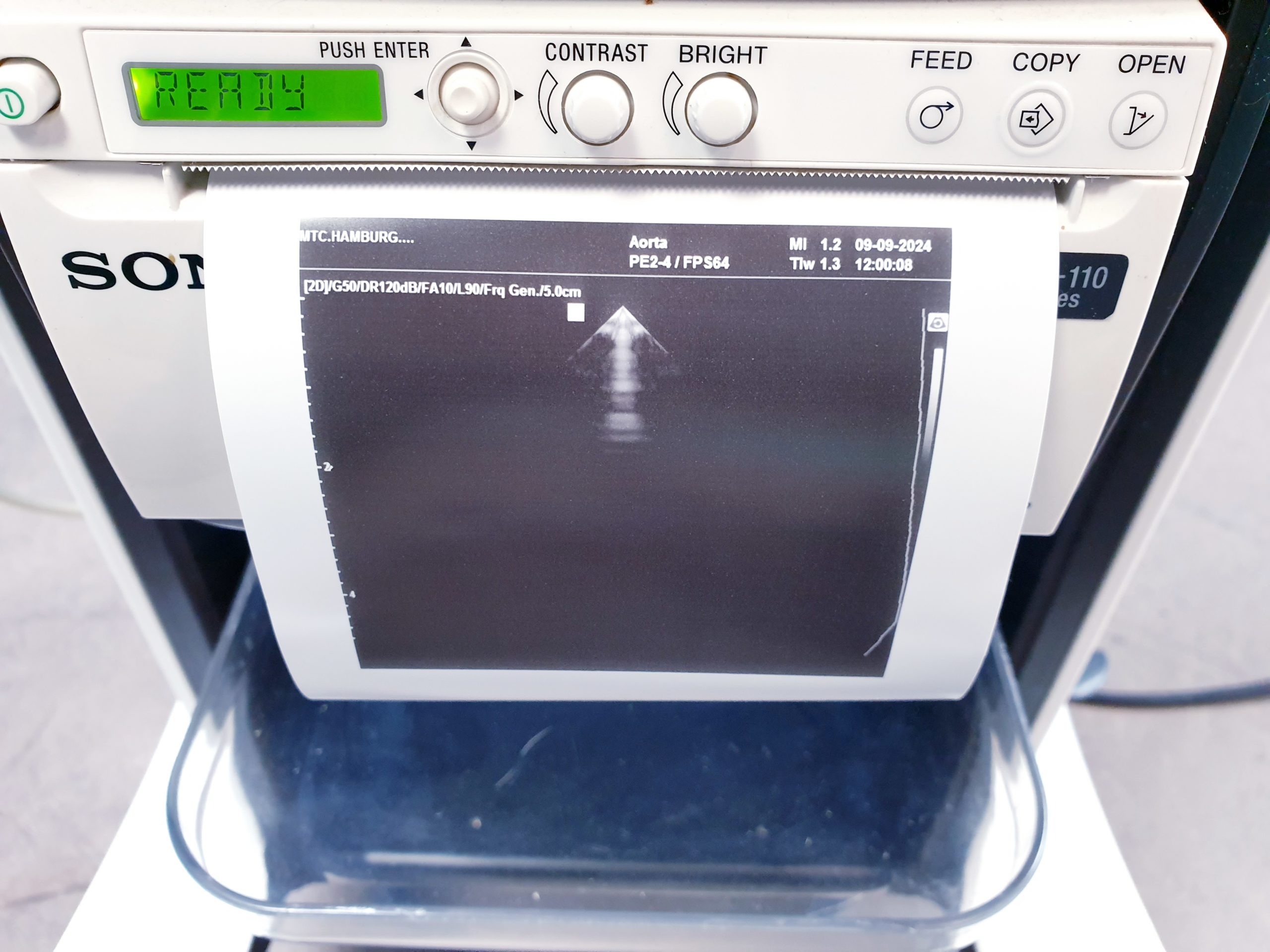 Samsung PE2-4 Sonde Echo Sonde Kardio Sonde thumbnail 4