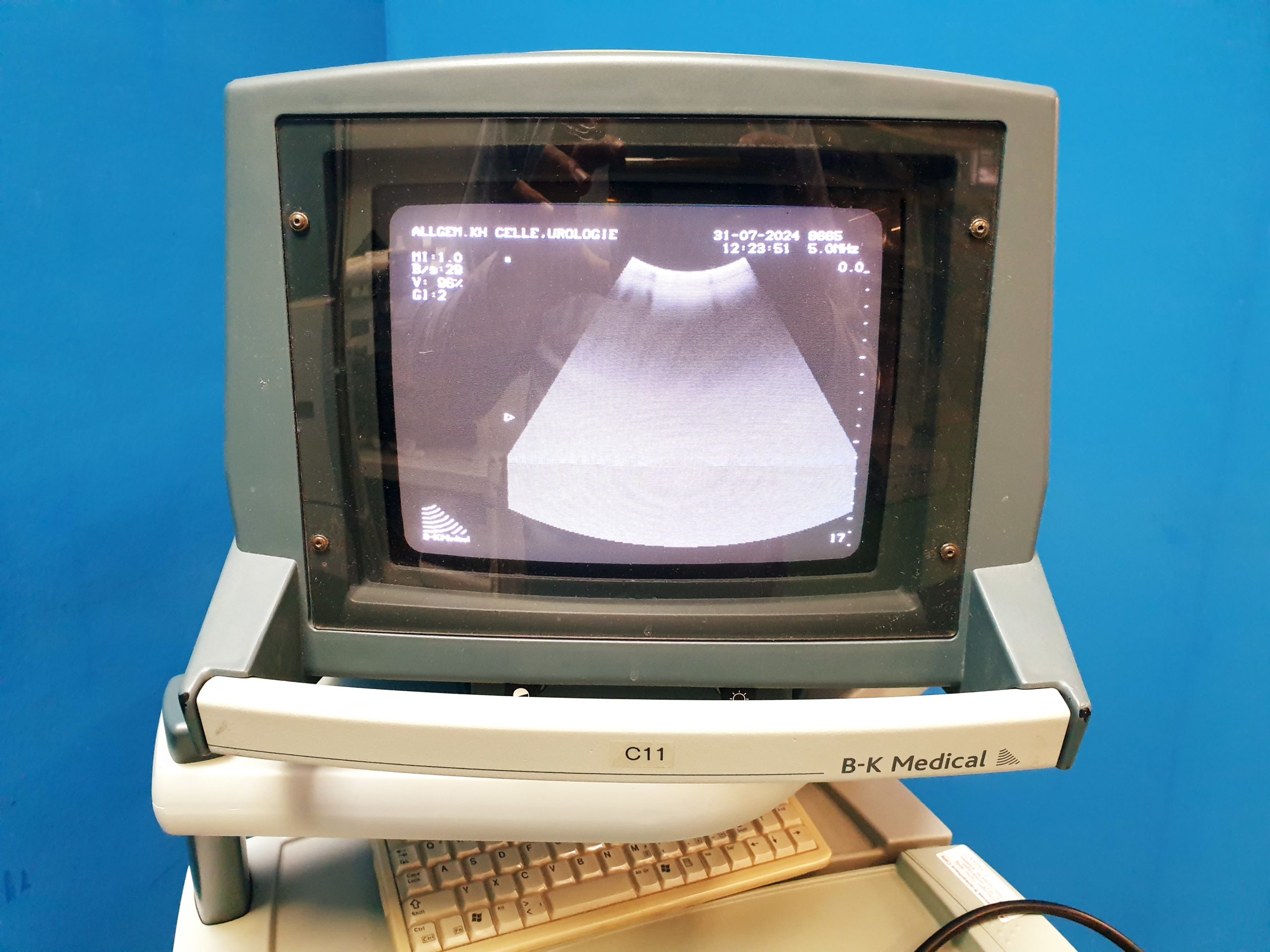 BK Medical REF Type 8665 3.5 MHz Konvex Sonde thumbnail 2