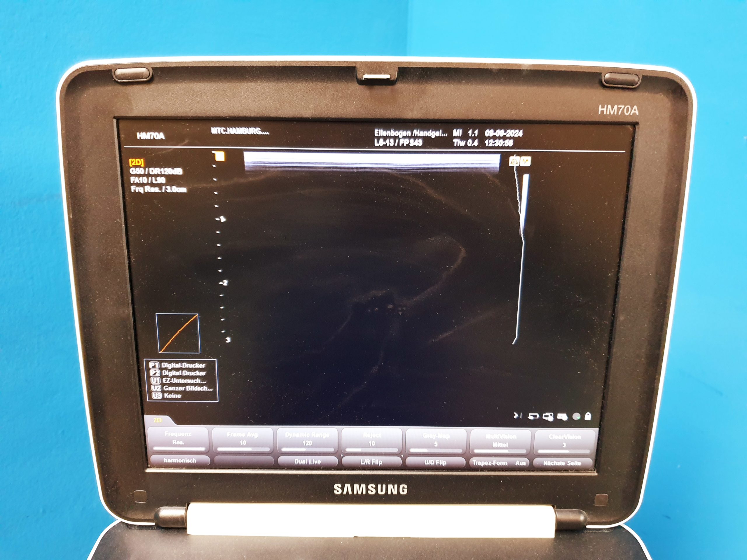 Samsung HM70A + L5-13IS Linear Sonde – Gehäuse hat paar Schäden – DOM 2016 thumbnail 4