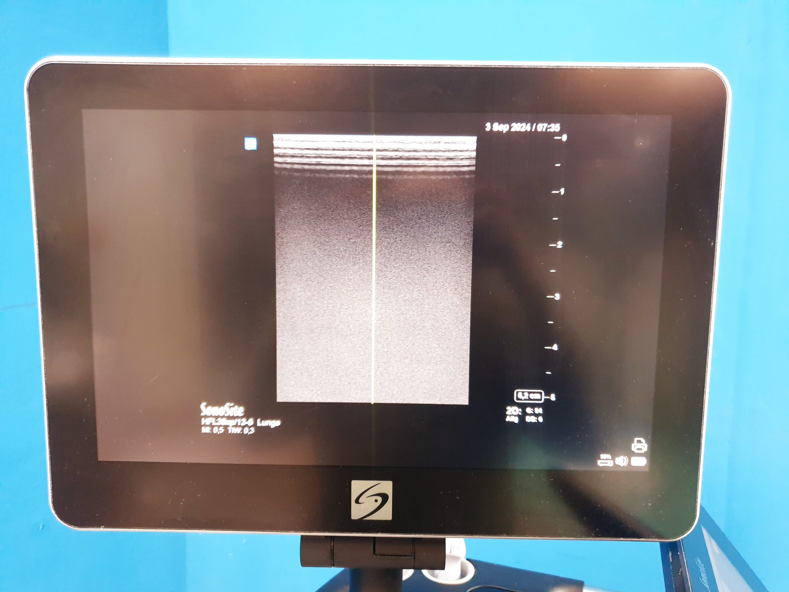 Fuji Sonosite X Porte Ultraschall + HFL38xp + C60xp + P21xp thumbnail 10