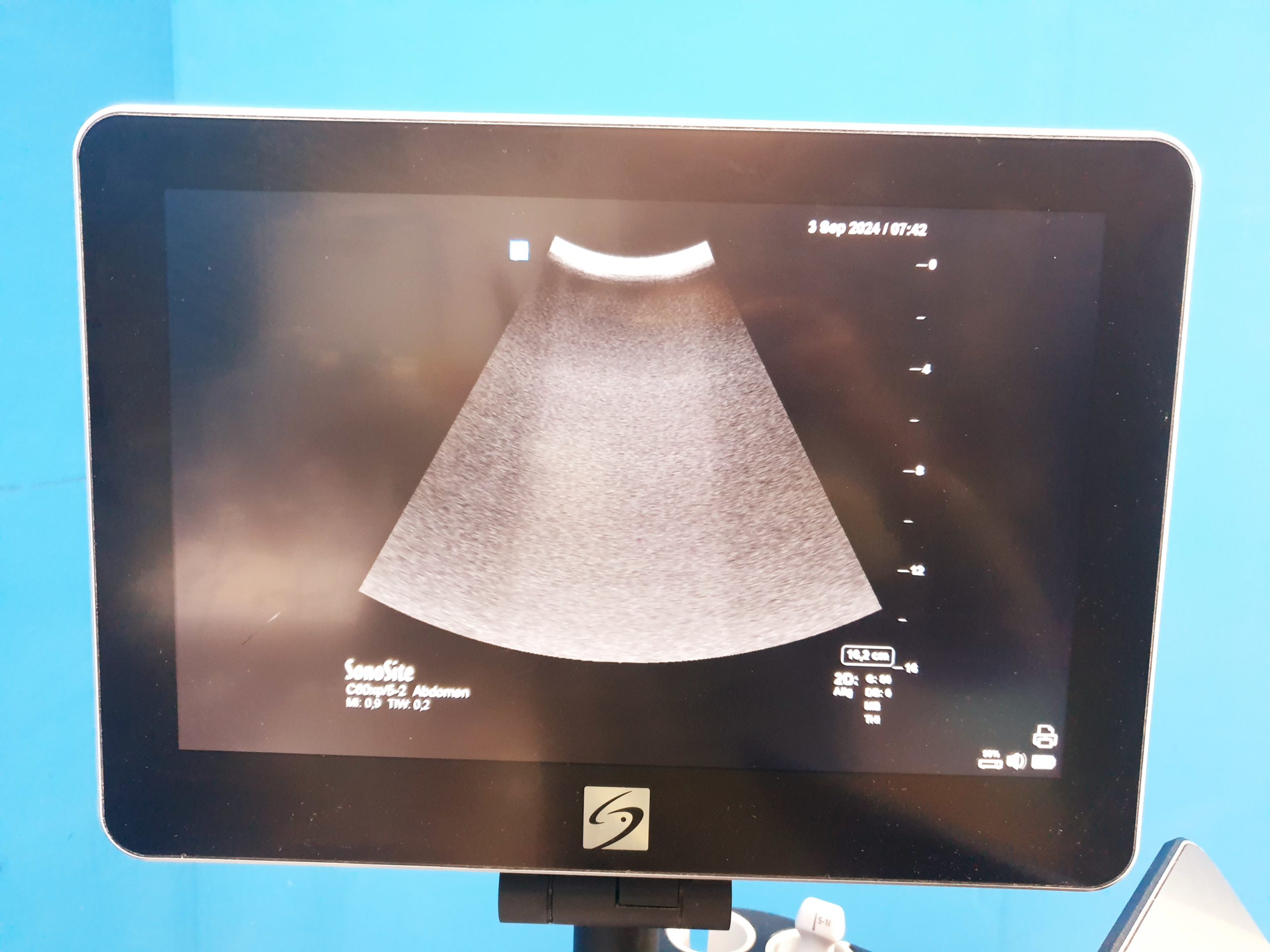 Fuji Sonosite X Porte Ultraschall + HFL38xp + C60xp + P21xp thumbnail 14