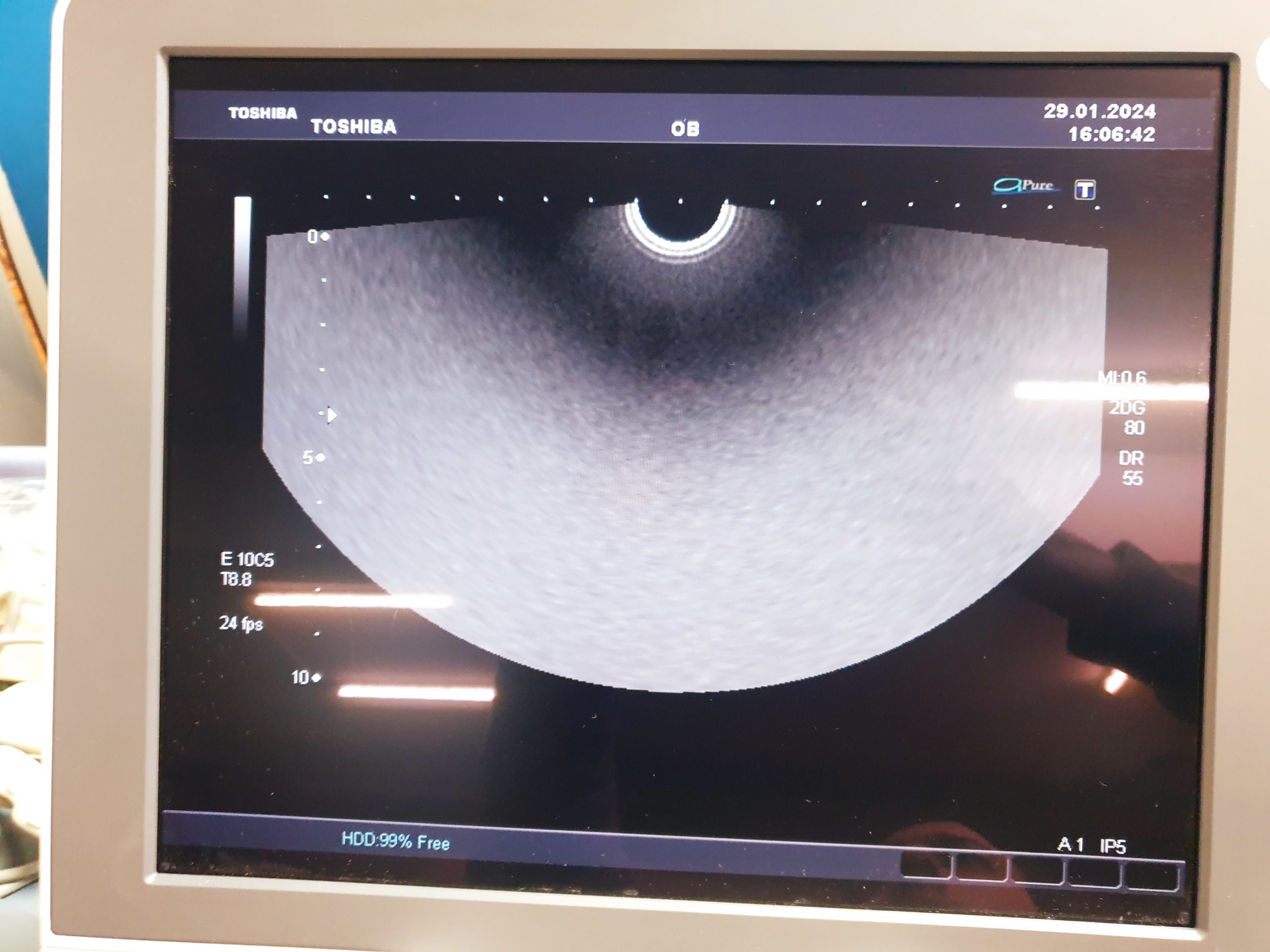 Toshiba PVT-770rt PVT 770 RT Endorectal Transducer Aplio Xario, thumbnail 5