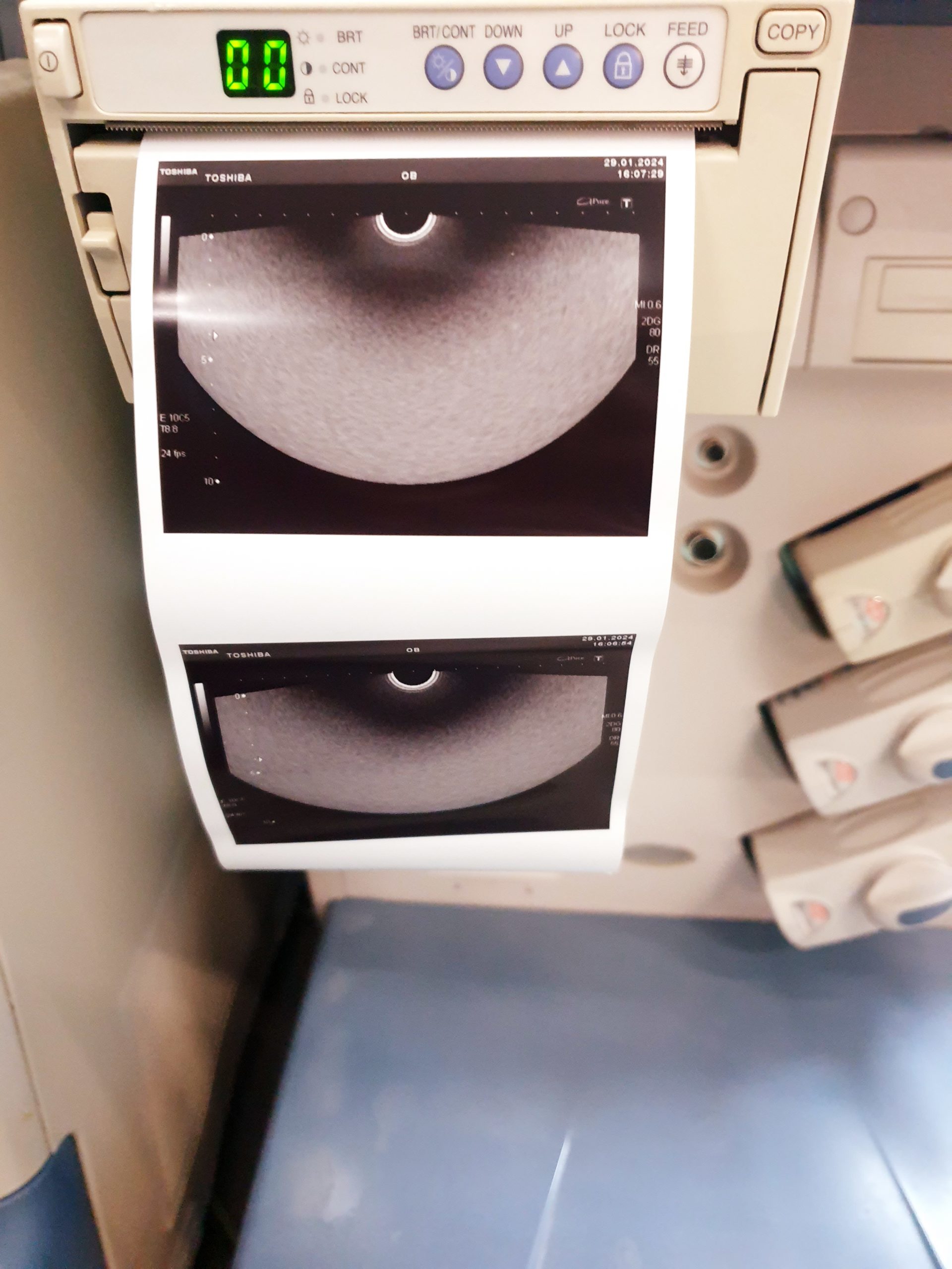 Toshiba PVT-770rt PVT 770 RT Endorectal Transducer Aplio Xario, thumbnail 6