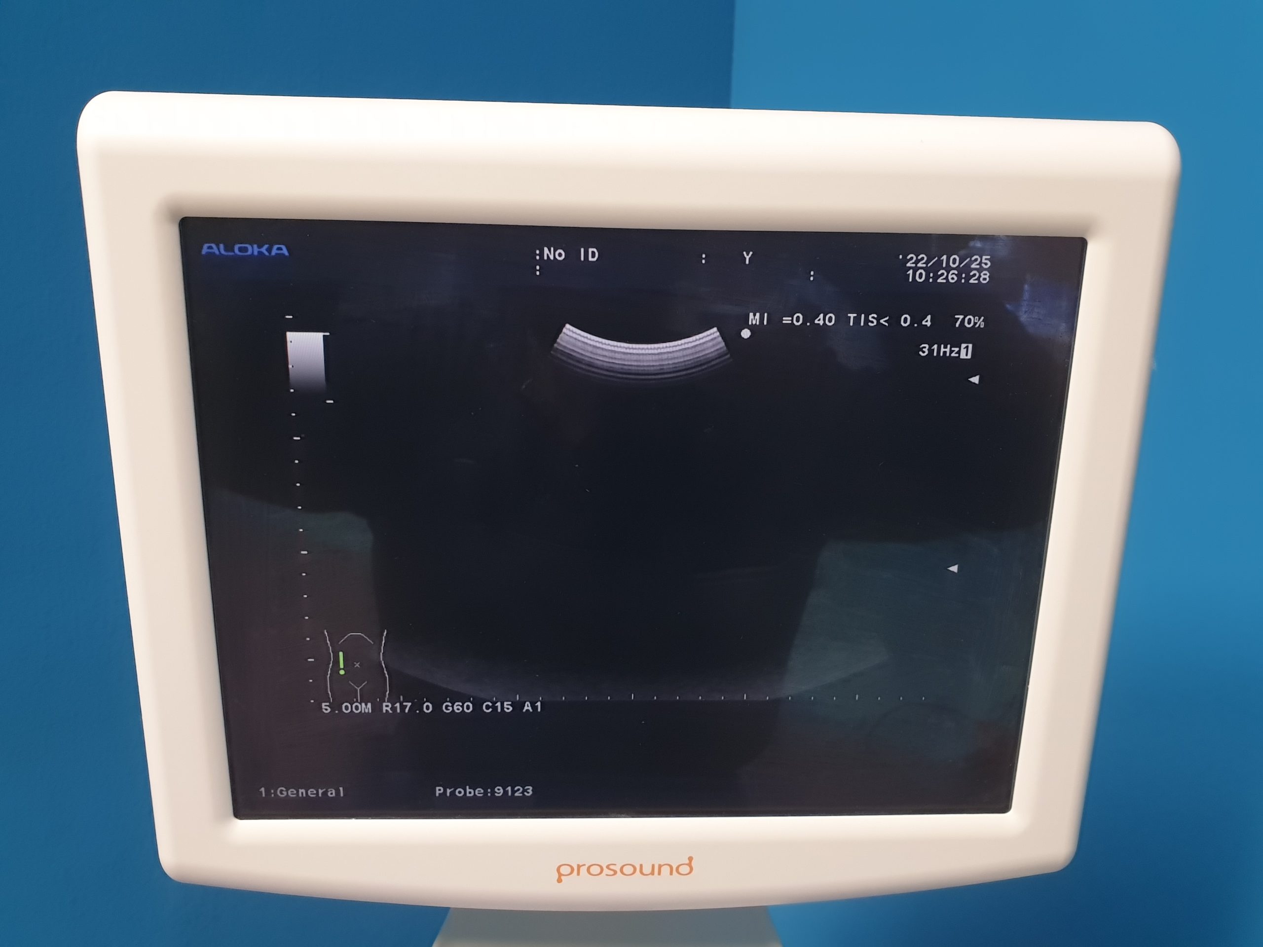 ALOKA ProSound Alpha 6 3D/4D + UST-9123 + UST-568 + UST-5124 // DOM 2011 thumbnail 5