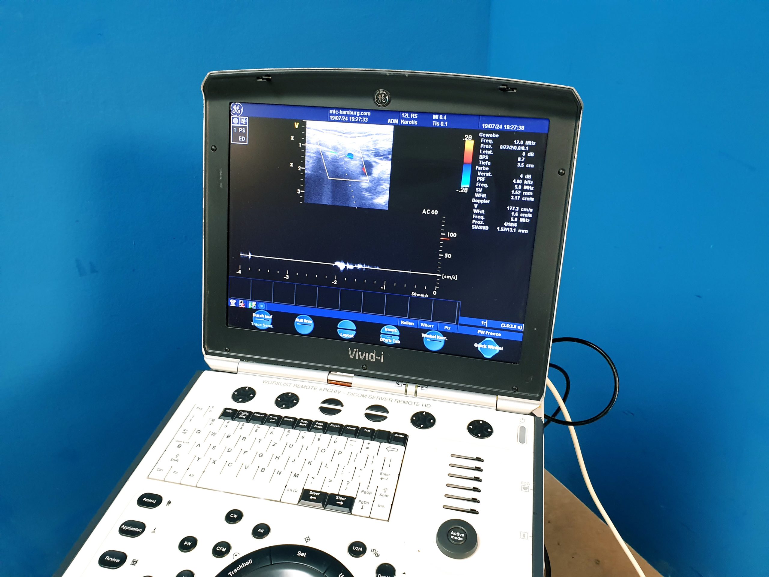 GE Vivid i Ultraschallgerät + 3S + 12S-RS mit 2x Sonden Software Version 2.0.16 auf GE Vivid i Trolley thumbnail 10