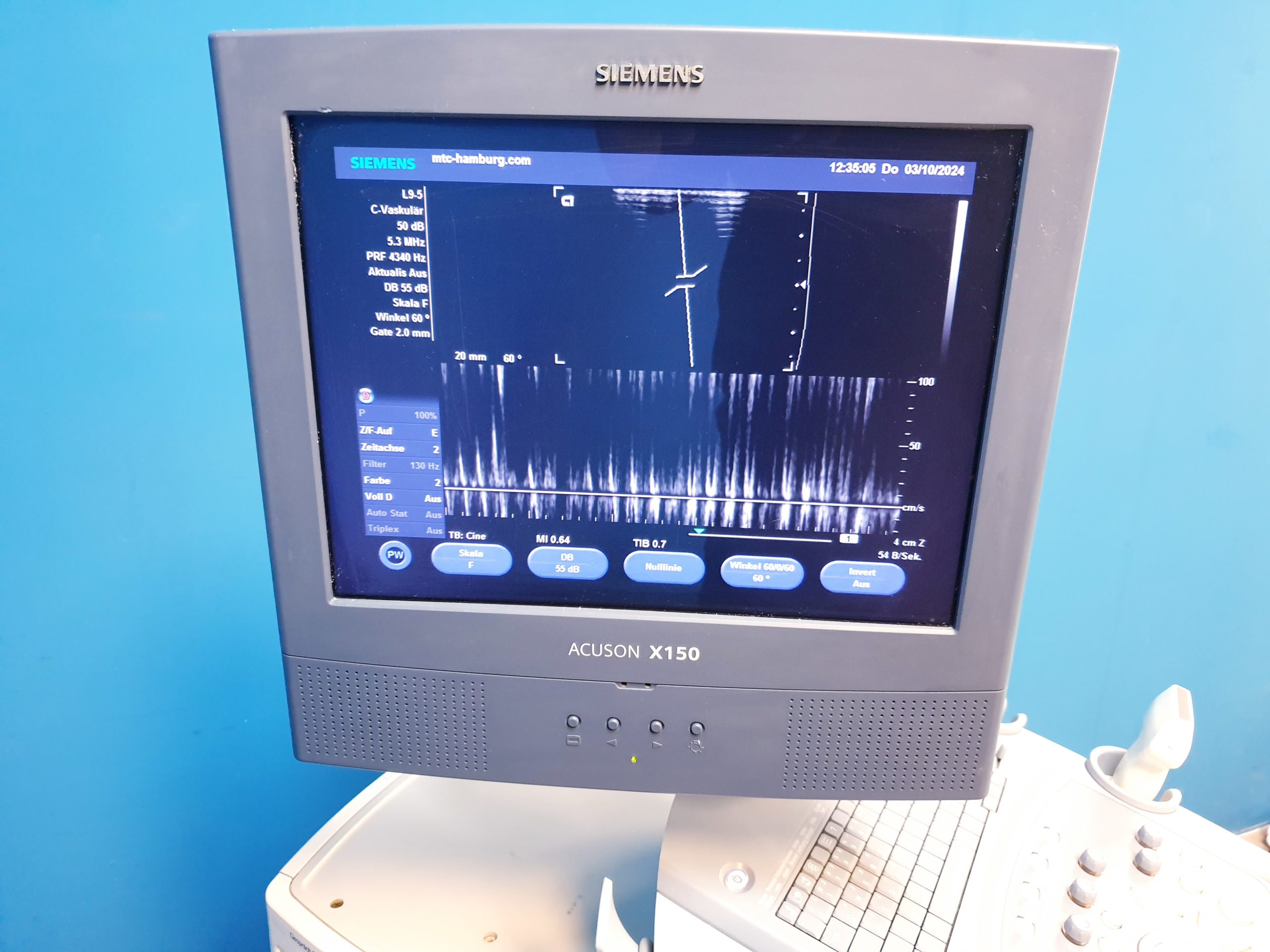 Siemens Acuson X150 + L9-5 Linear thumbnail 3