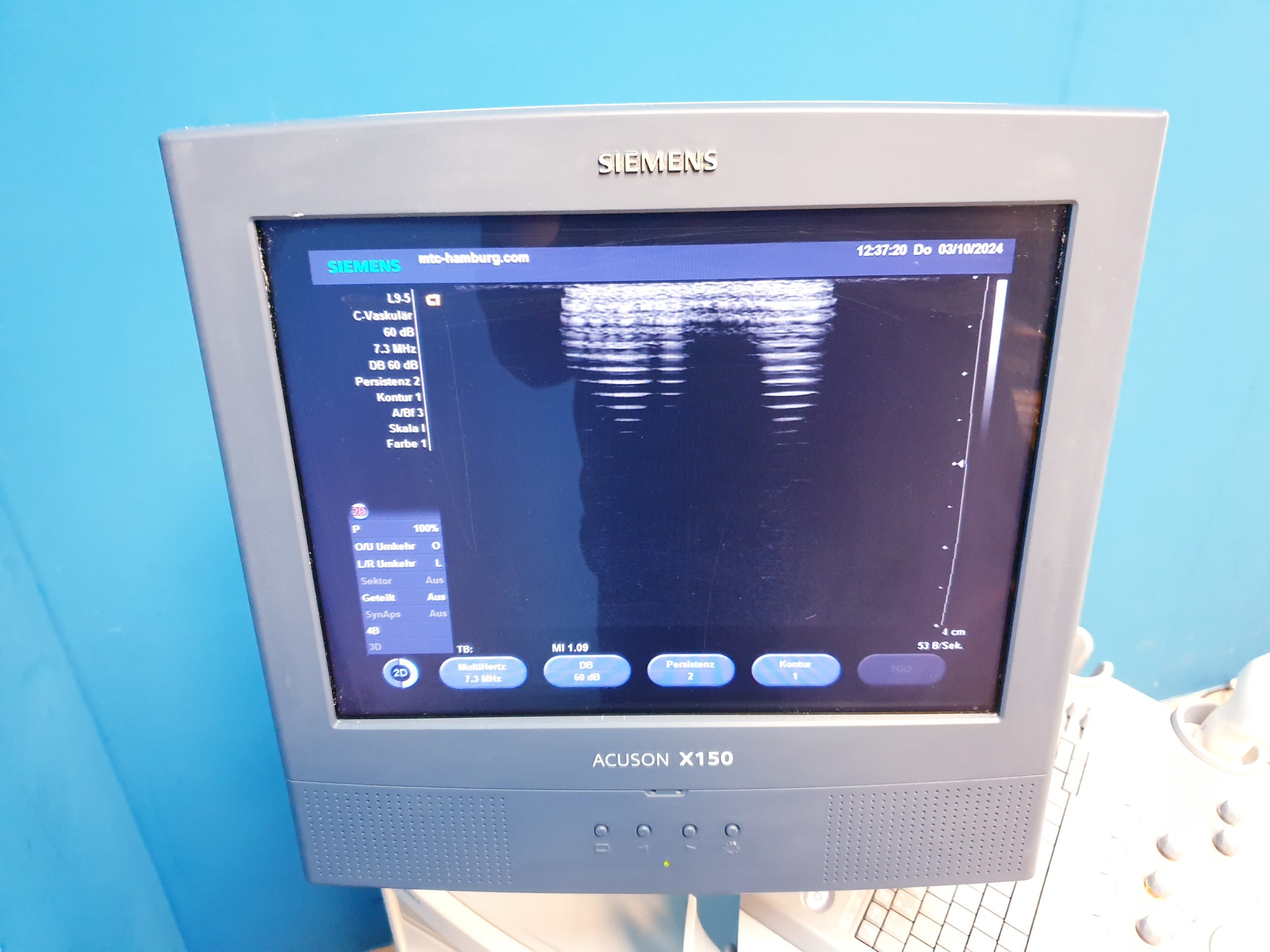 Siemens Acuson X150 + L9-5 Linear thumbnail 7
