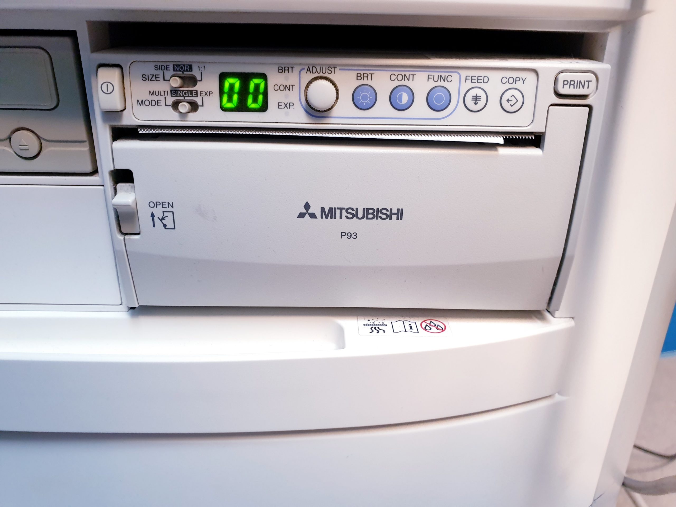Siemens Acuson X150 + L9-5 Linear thumbnail 8