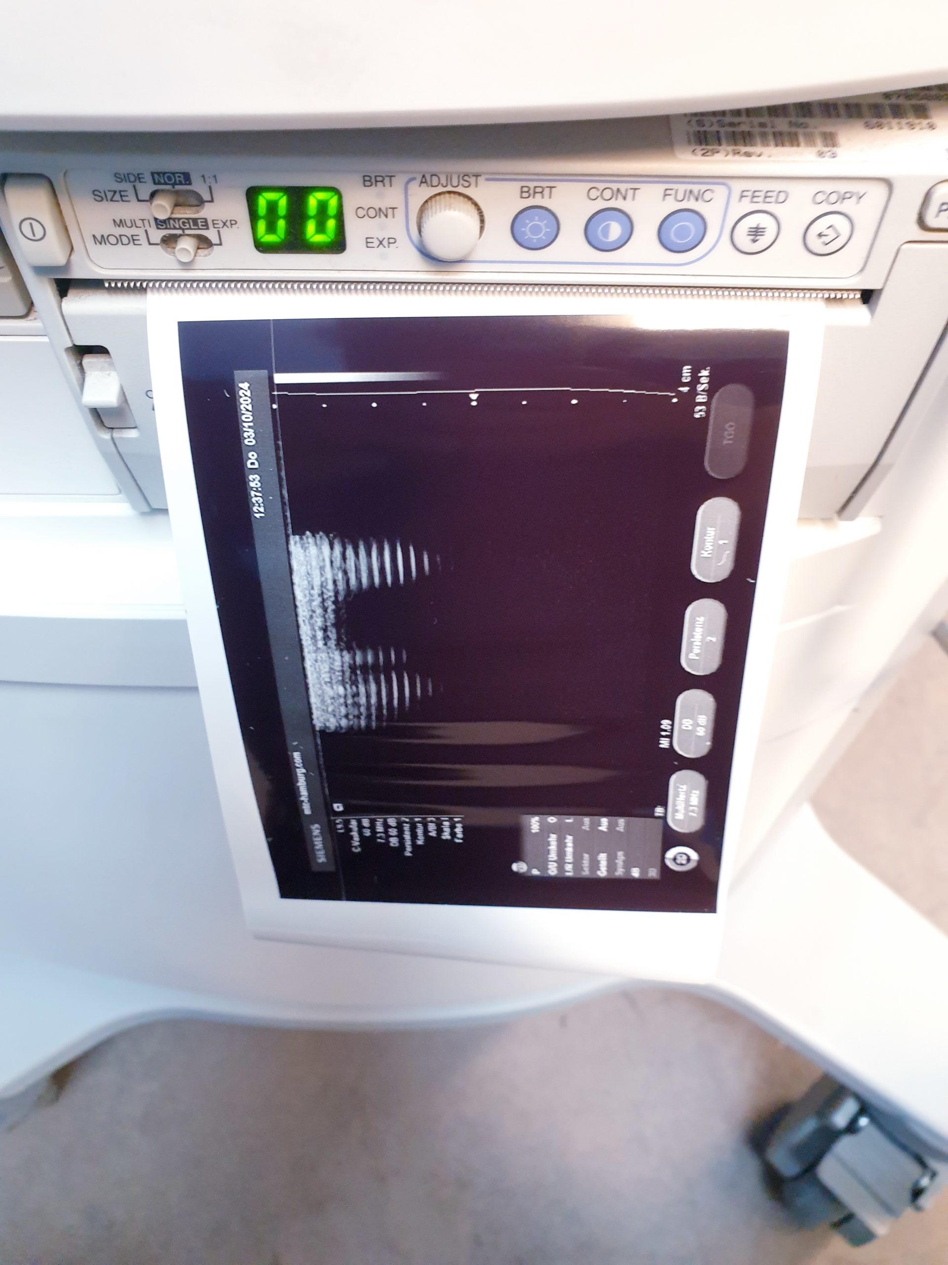 Siemens Acuson X150 + L9-5 Linear thumbnail 9