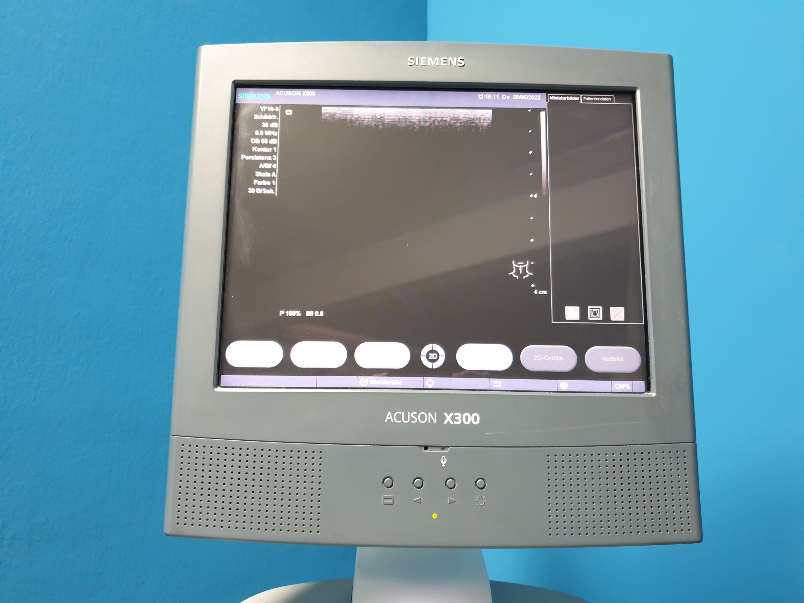 SIEMENS X300 // X 300 CH5-2 + P4-2 Sonden + VF10-5 Linear – Konvex + Echo + Linear – Kardiomaschine DOM 2009 thumbnail 6
