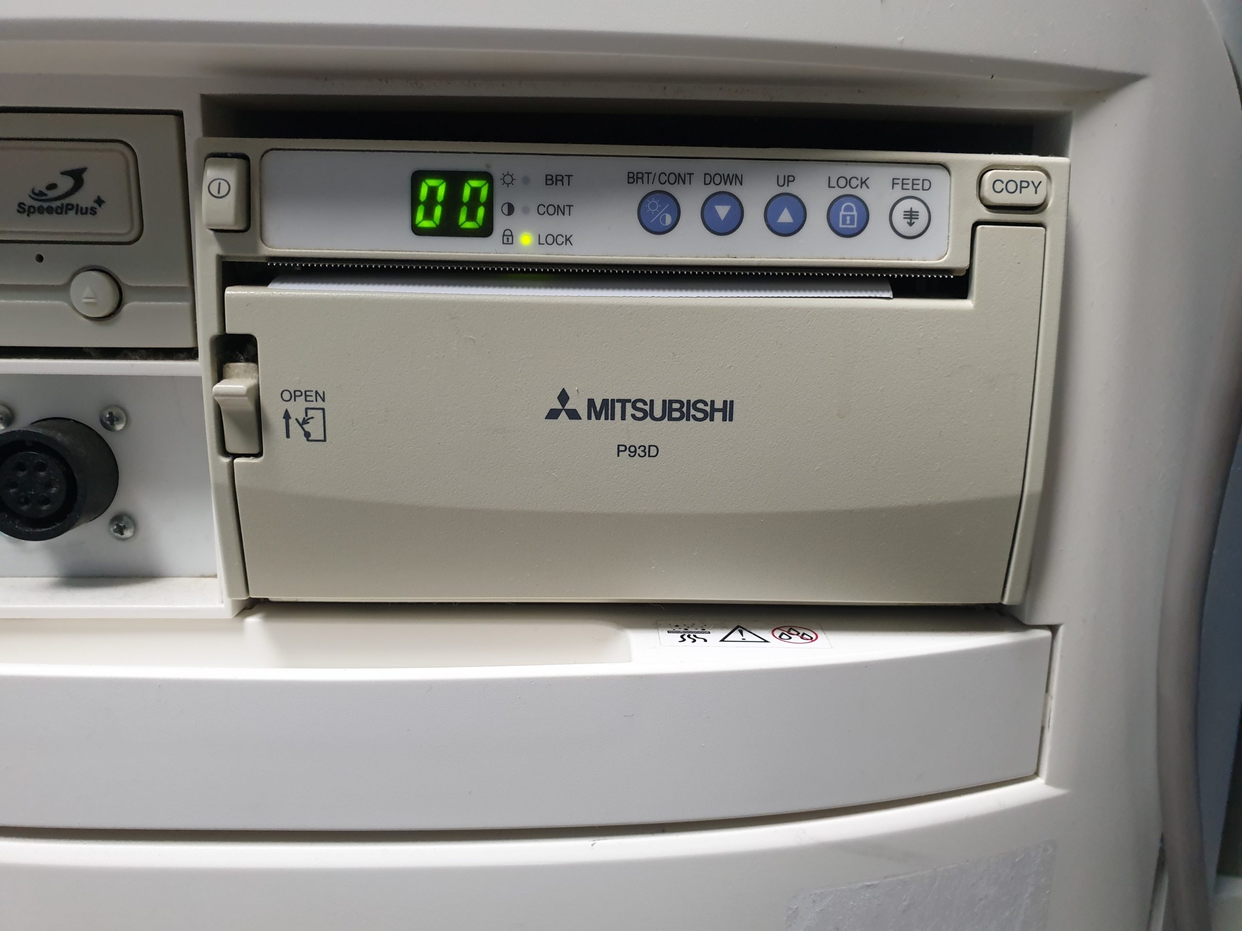 SIEMENS X300 // X 300 CH5-2 + P4-2 Sonden + VF10-5 Linear – Konvex + Echo + Linear – Kardiomaschine DOM 2009 thumbnail 12