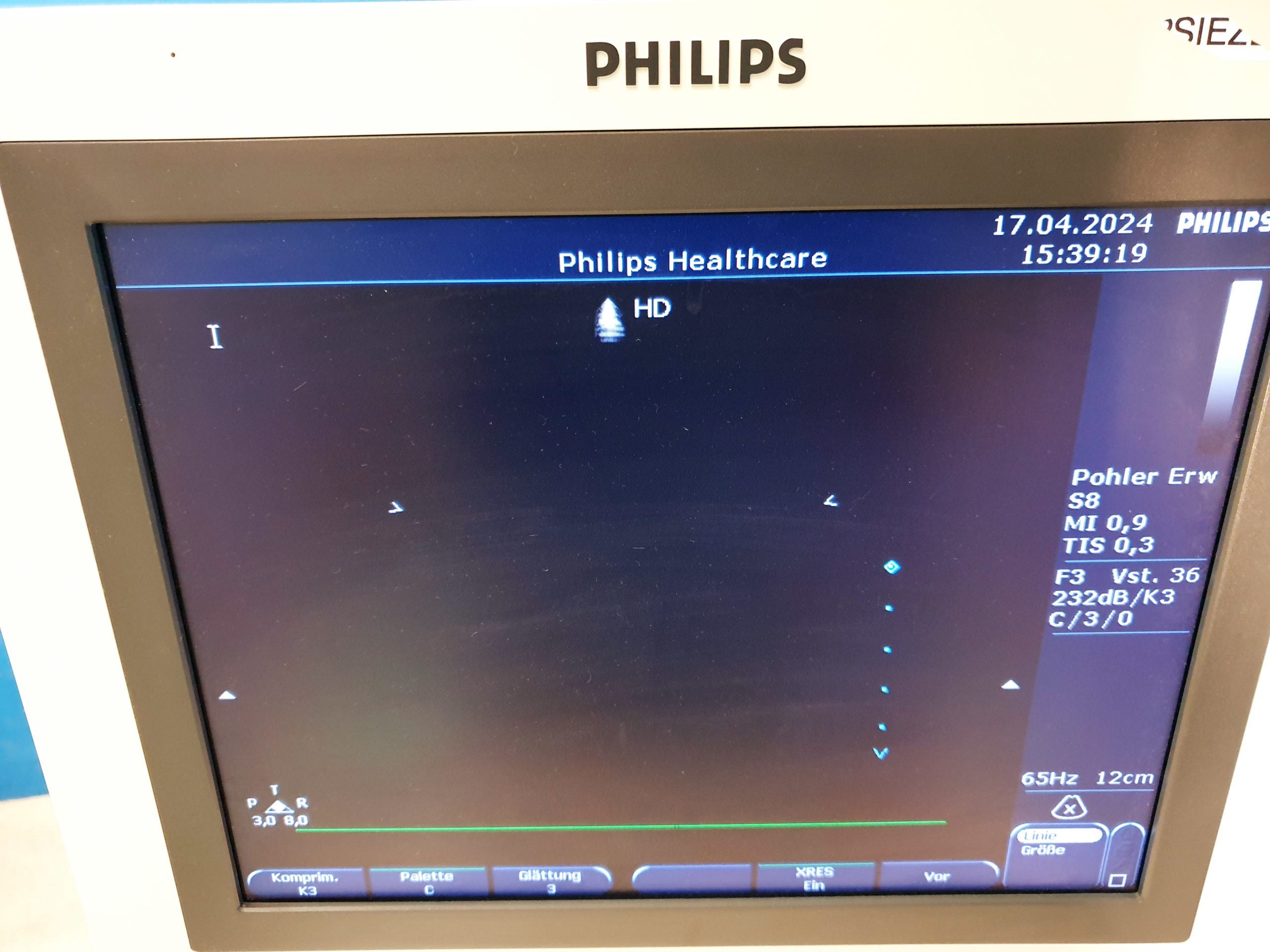 Philips S8 Ultrasound Transducer 21350A IPX-7 thumbnail 3