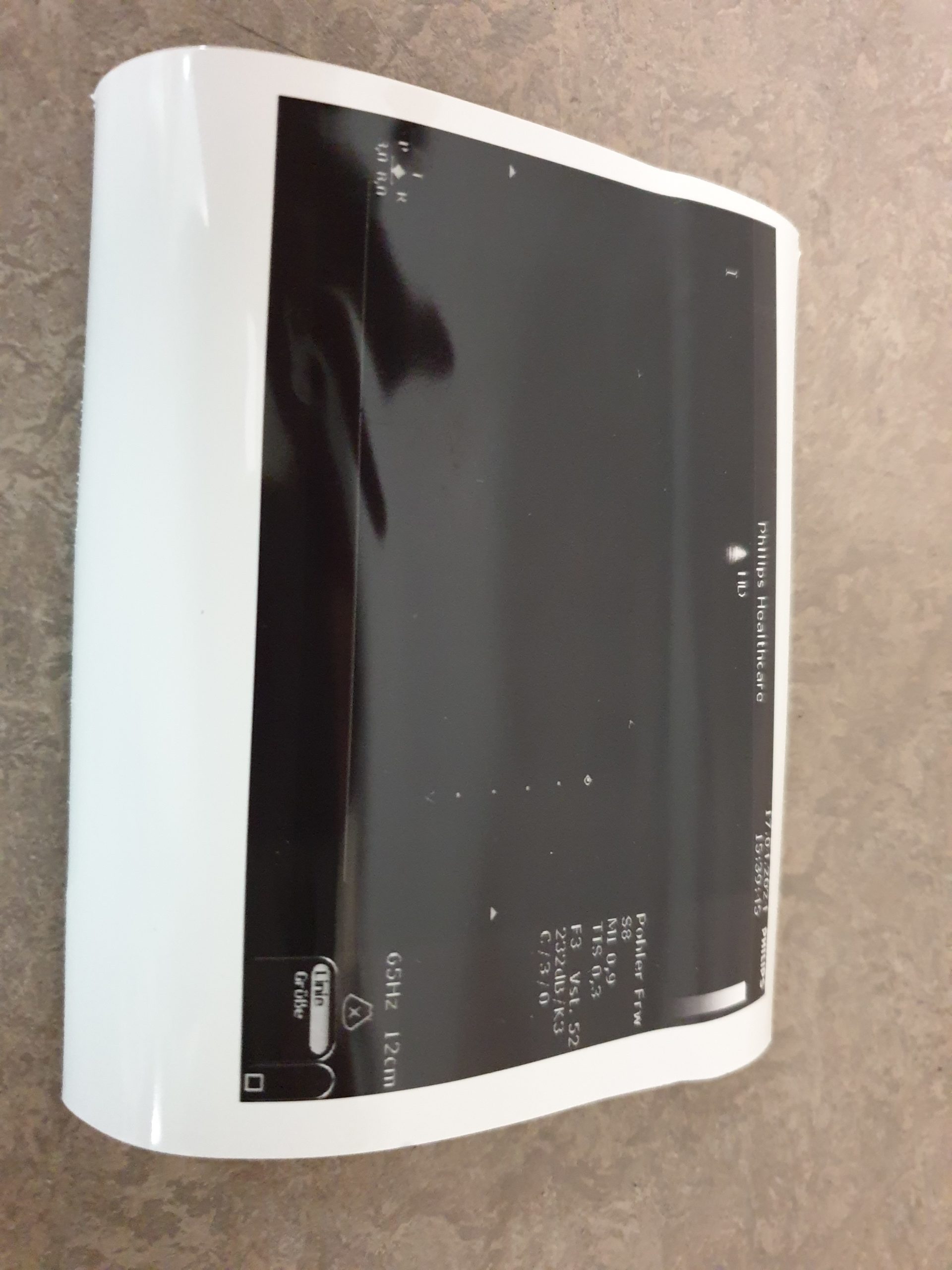 Philips S8 Ultrasound Transducer 21350A IPX-7 thumbnail 4