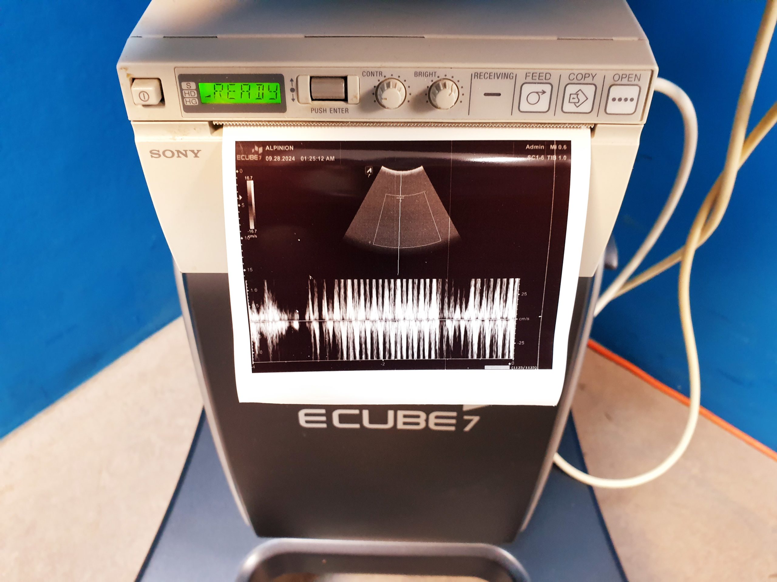 Alpinion E-Cube 7 Farbdoppler + SC1-6 Konvex Sonde thumbnail 4