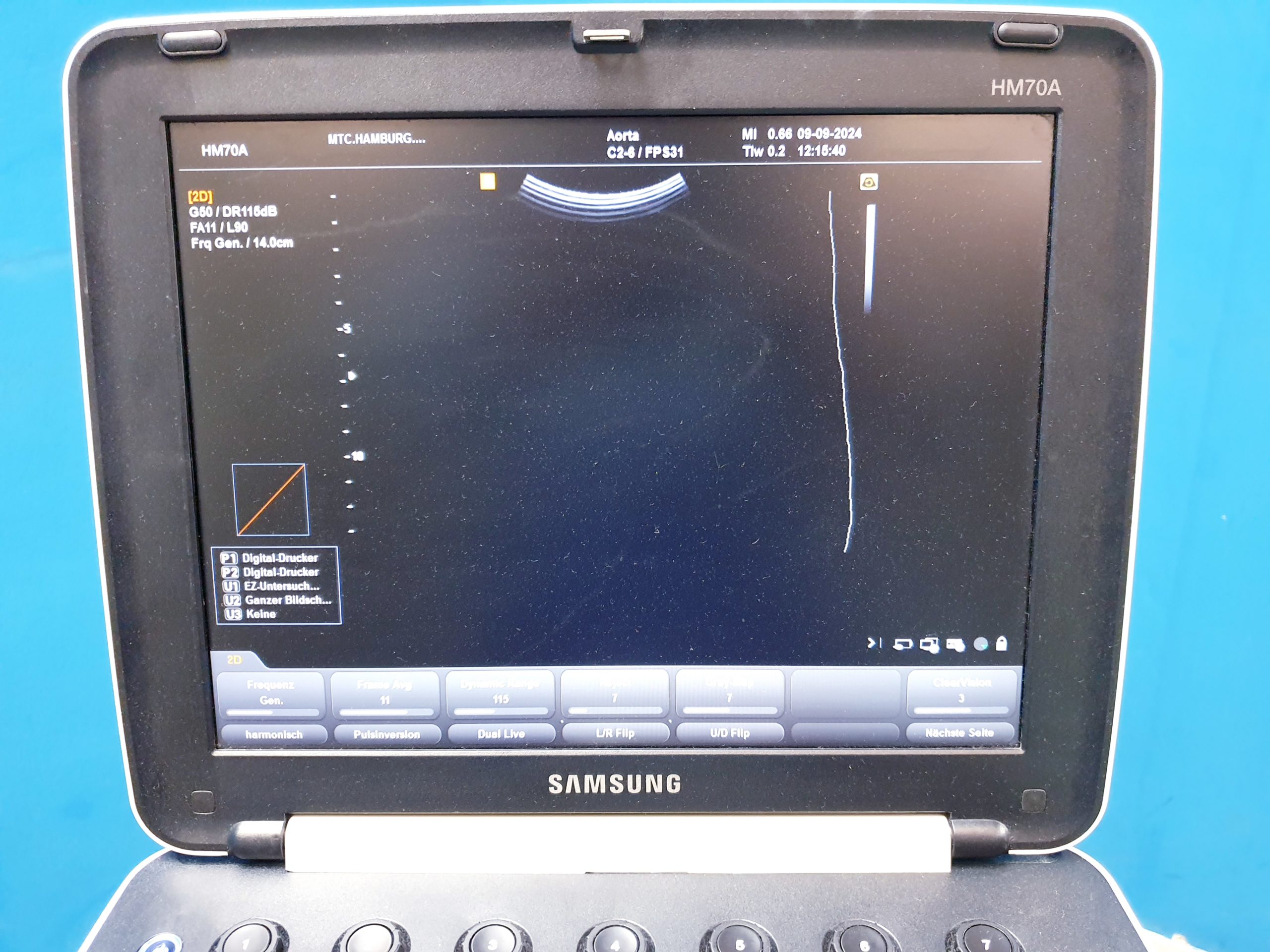 Samsung C2-6 Konvex für HM70A, Kabelbruch thumbnail 3