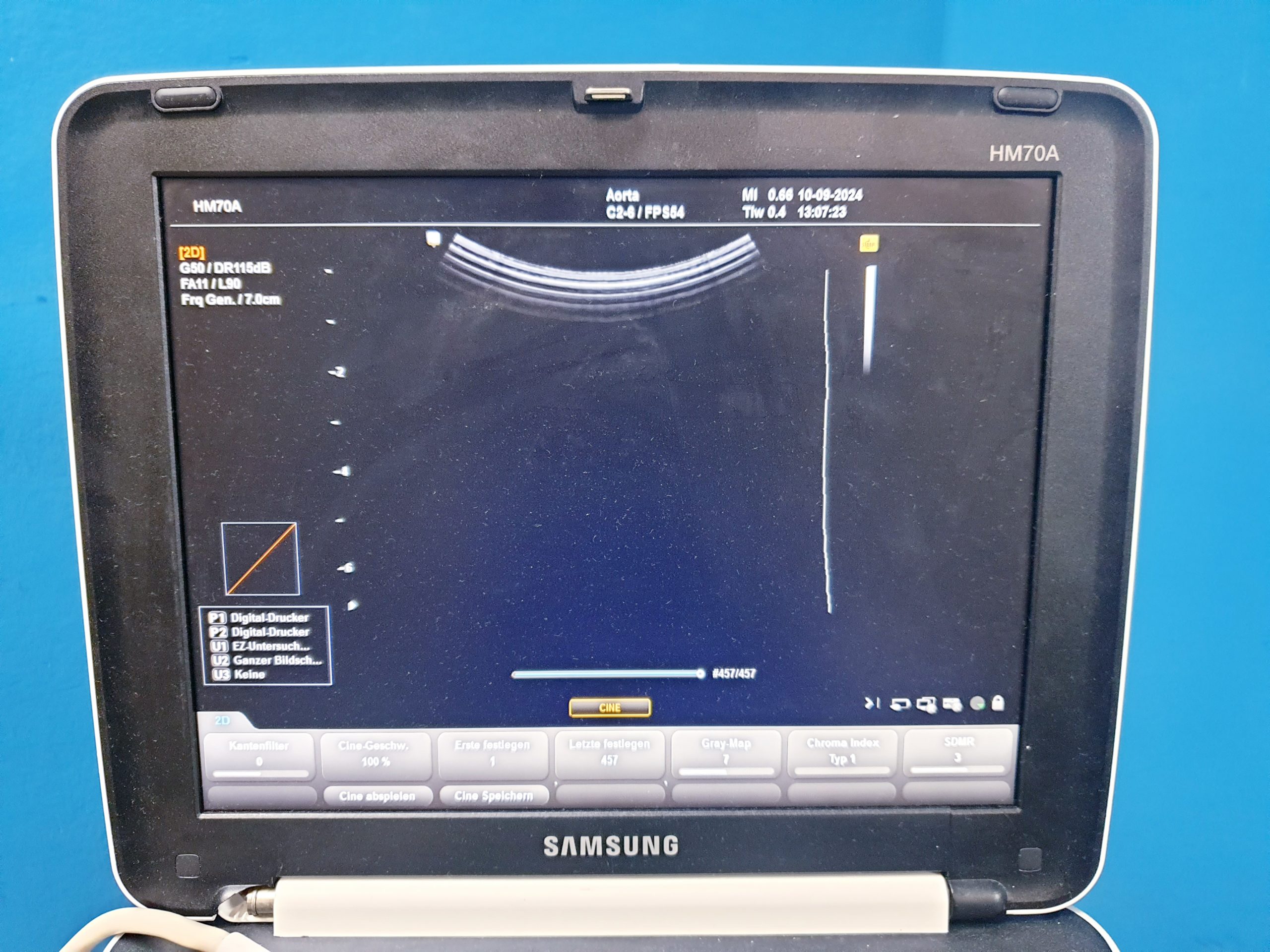 Samsung C2-6 Ultraschallsonde für HM-70A, thumbnail 4