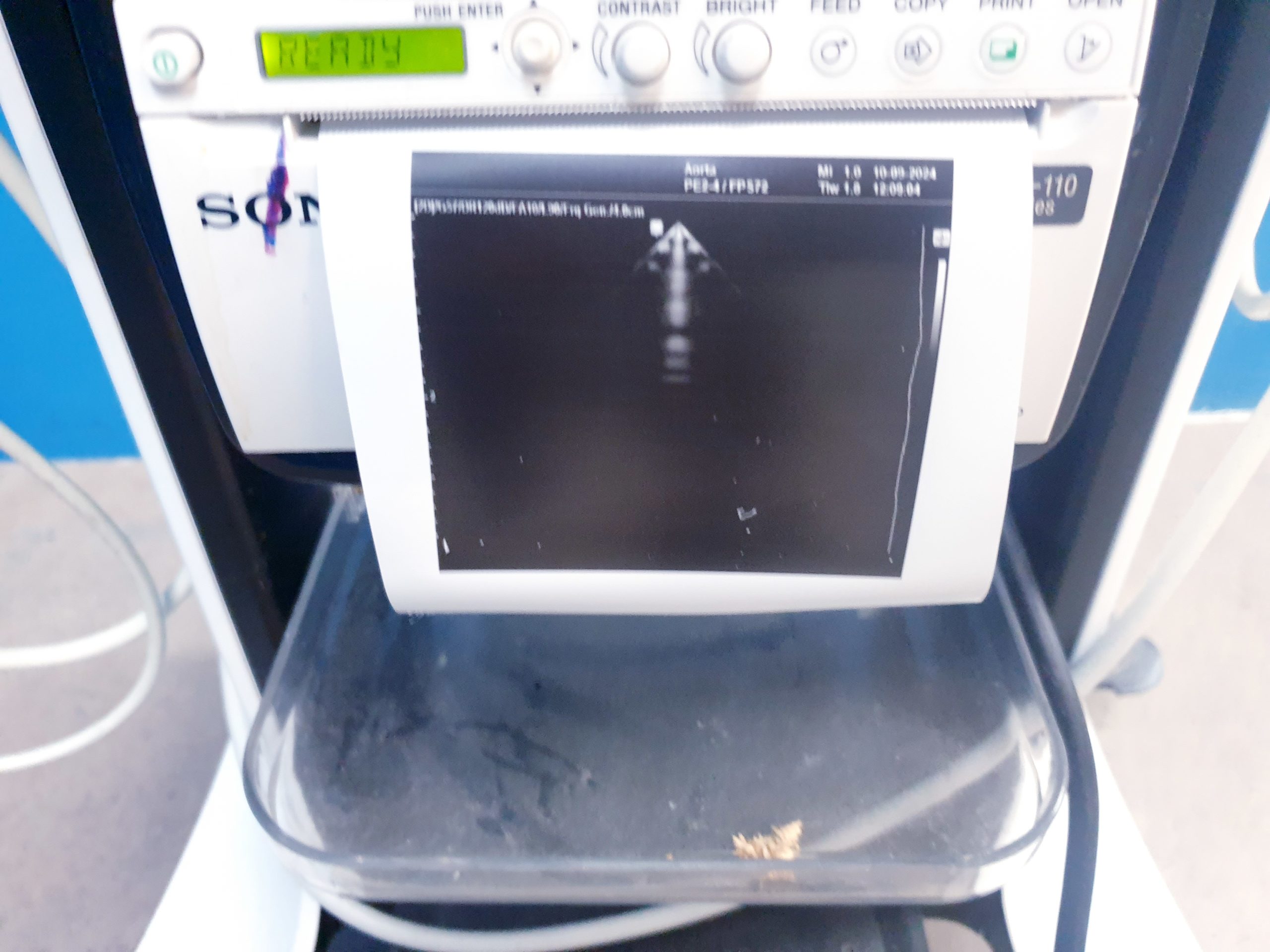Samsung-Medison PE2-4 Ultraschallsonde für HM-70A thumbnail 3
